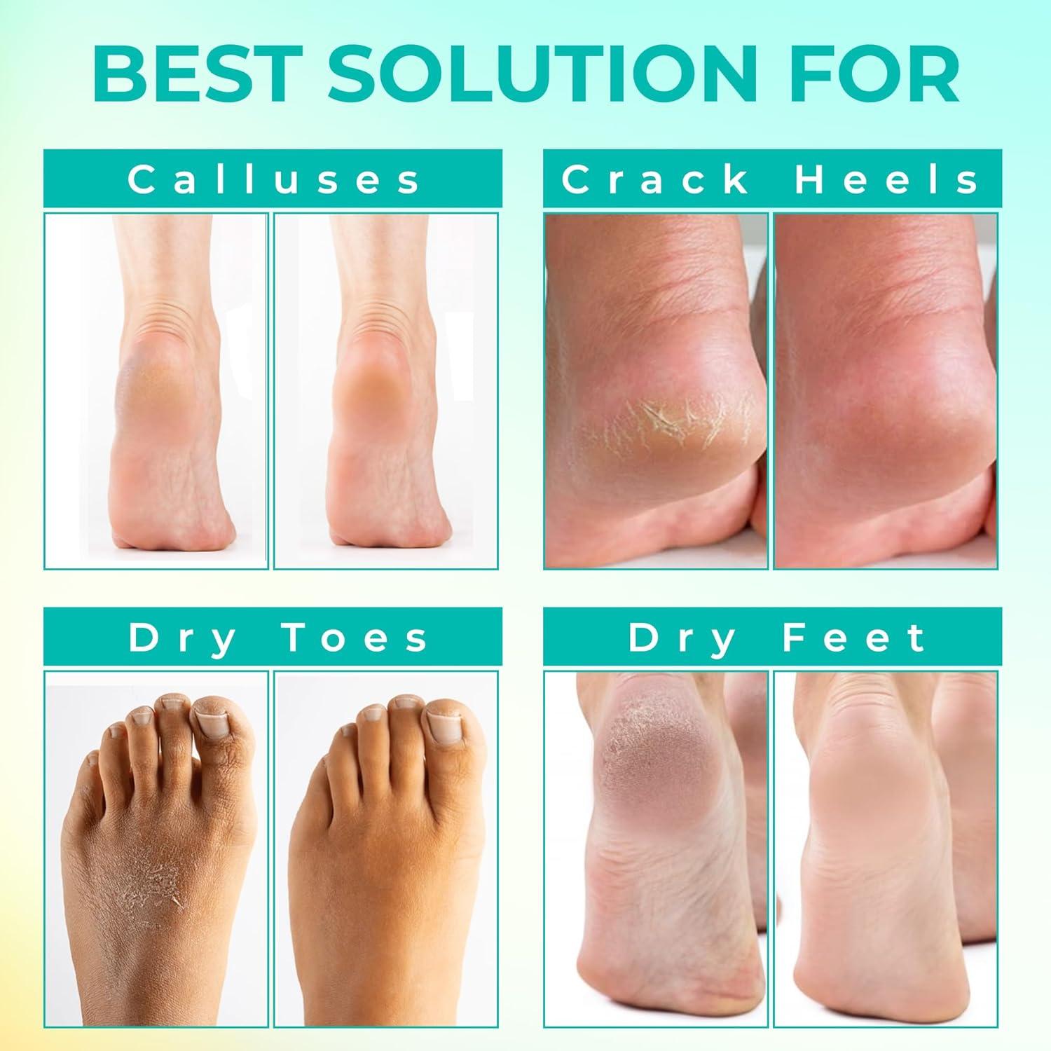 Máscara Exfoliante para Pies Happy Feet - 3 Paquetes 174g