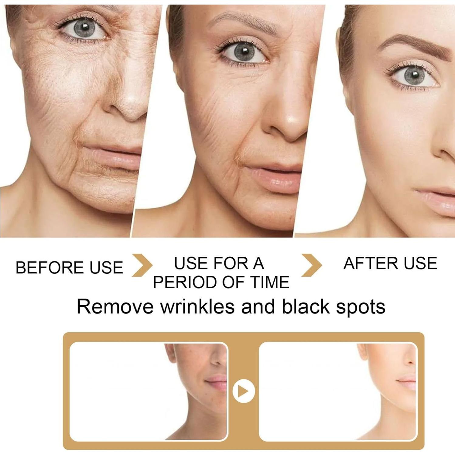 Suero Facial de Cúrcuma Aiwenchen 30ml - Corrector de Manchas