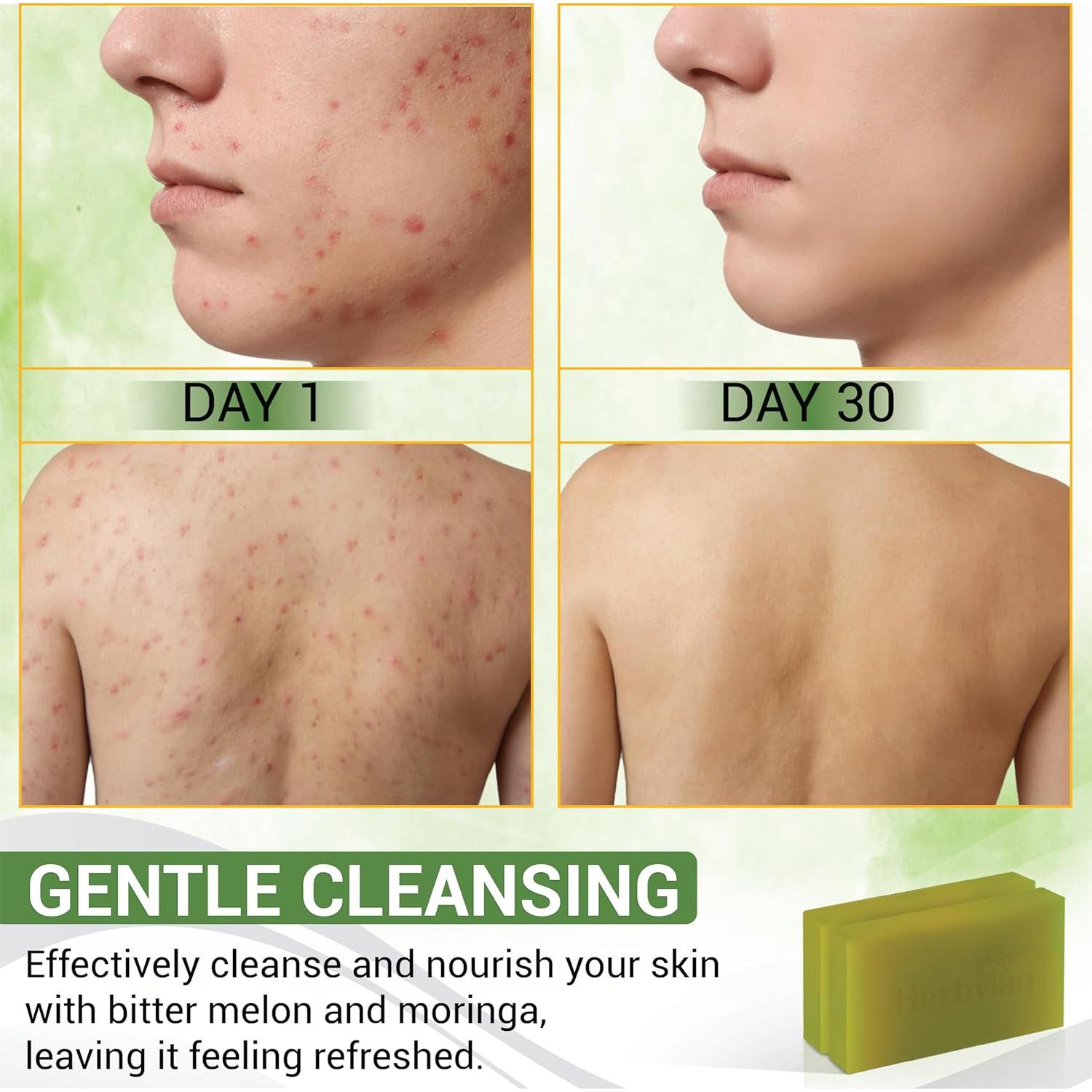 Jabón Antibacteriano Herbal 2 PCS Melón Amargo Moringa 200g