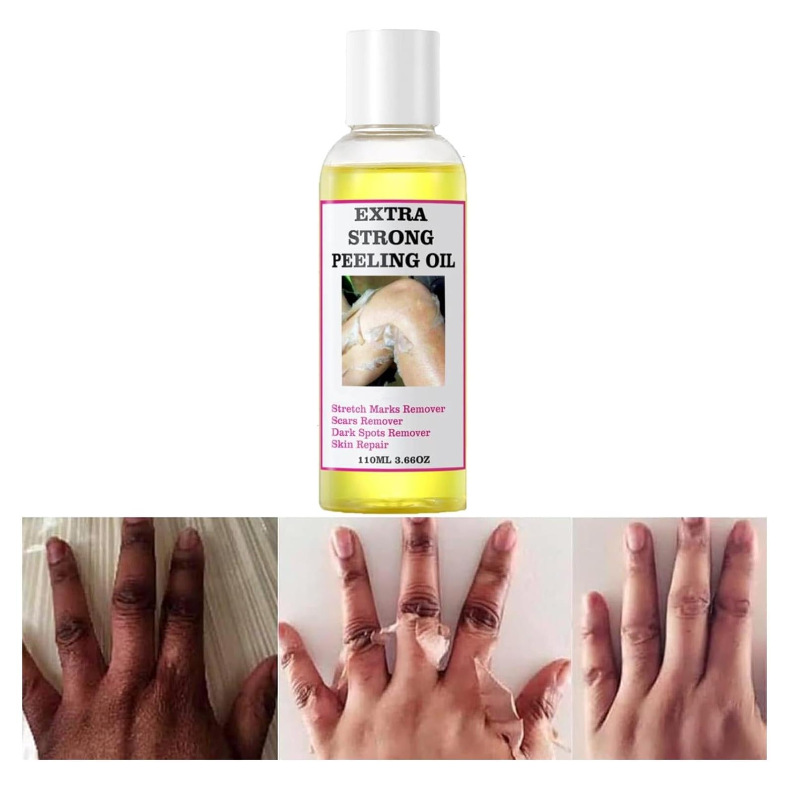 Aceite Exfoliante Amarillo Genérico 110ml - Piel Suave y Radiante