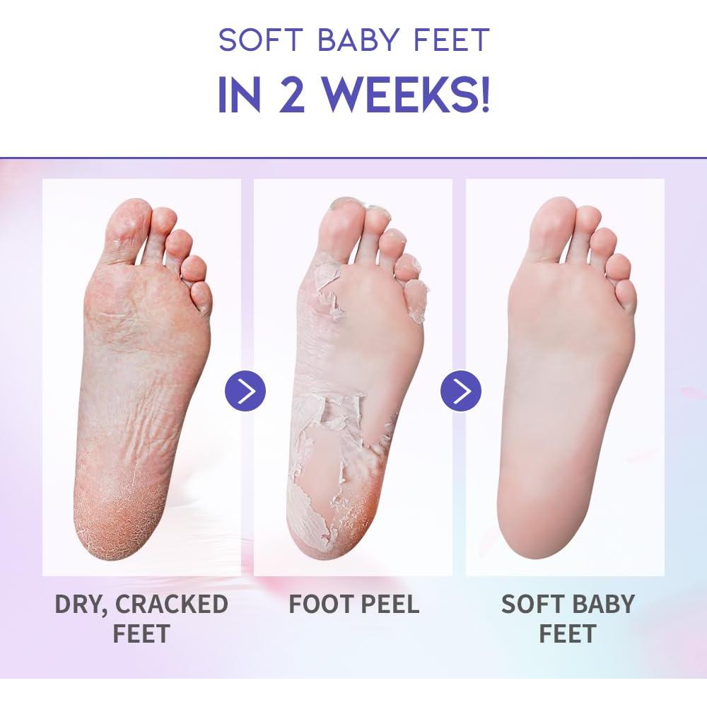 Máscara Exfoliante para Pies #OOTD Vegana AHA BHA 2 Paquete