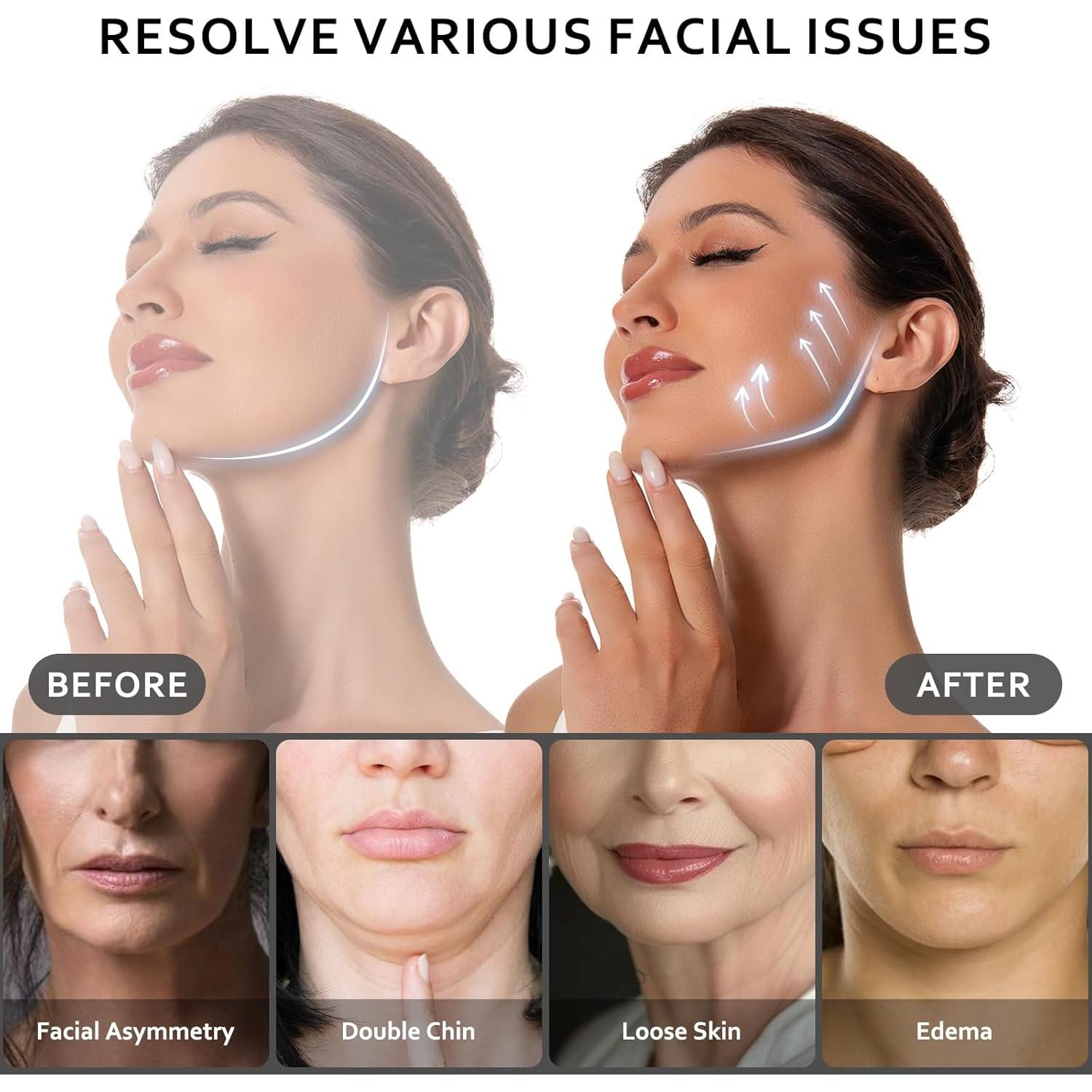 Correa para Barbilla Nackiy - Reutilizable, Ajustable, Negro