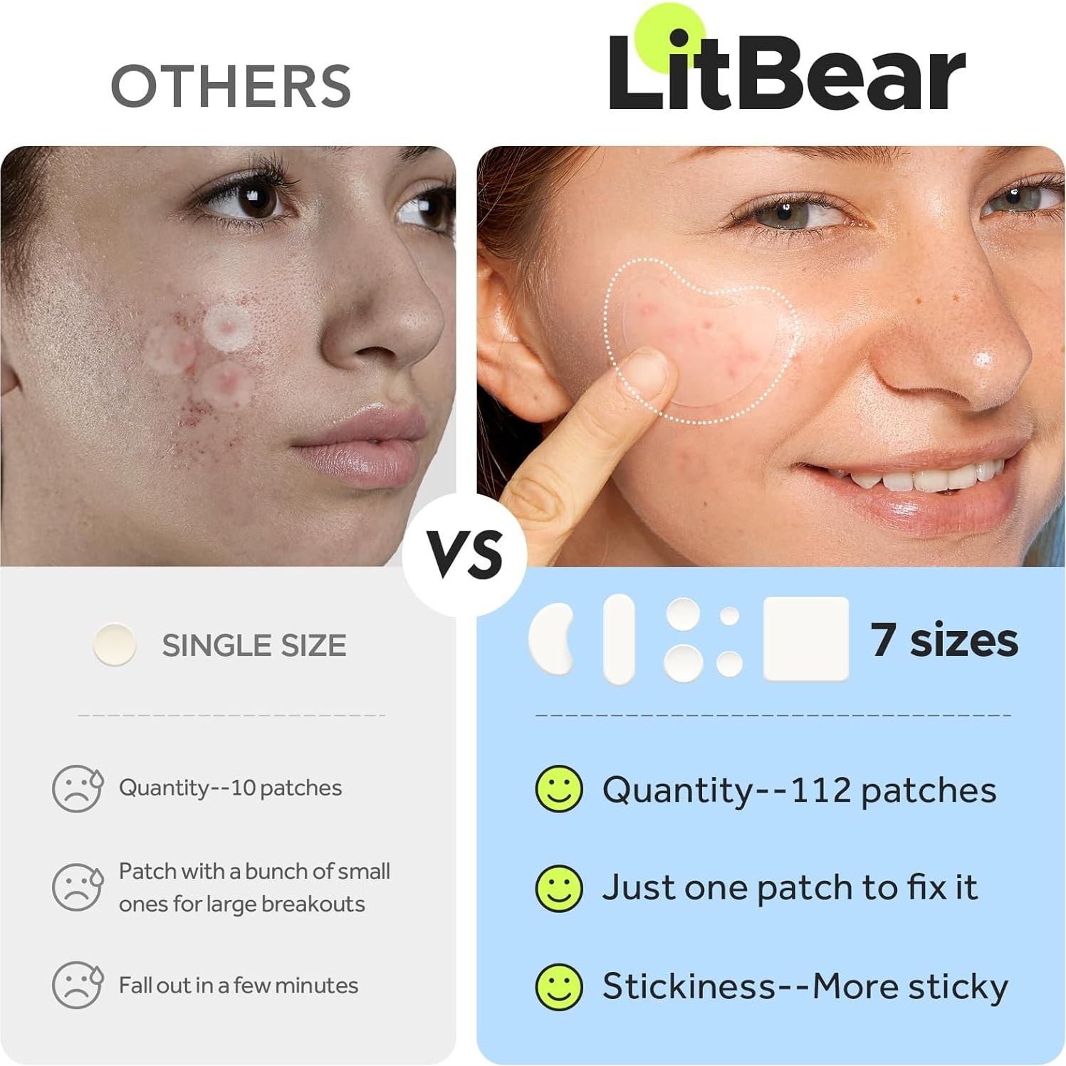 Parches Hidrocoloides para Granos LitBear - 112 Unidades XL