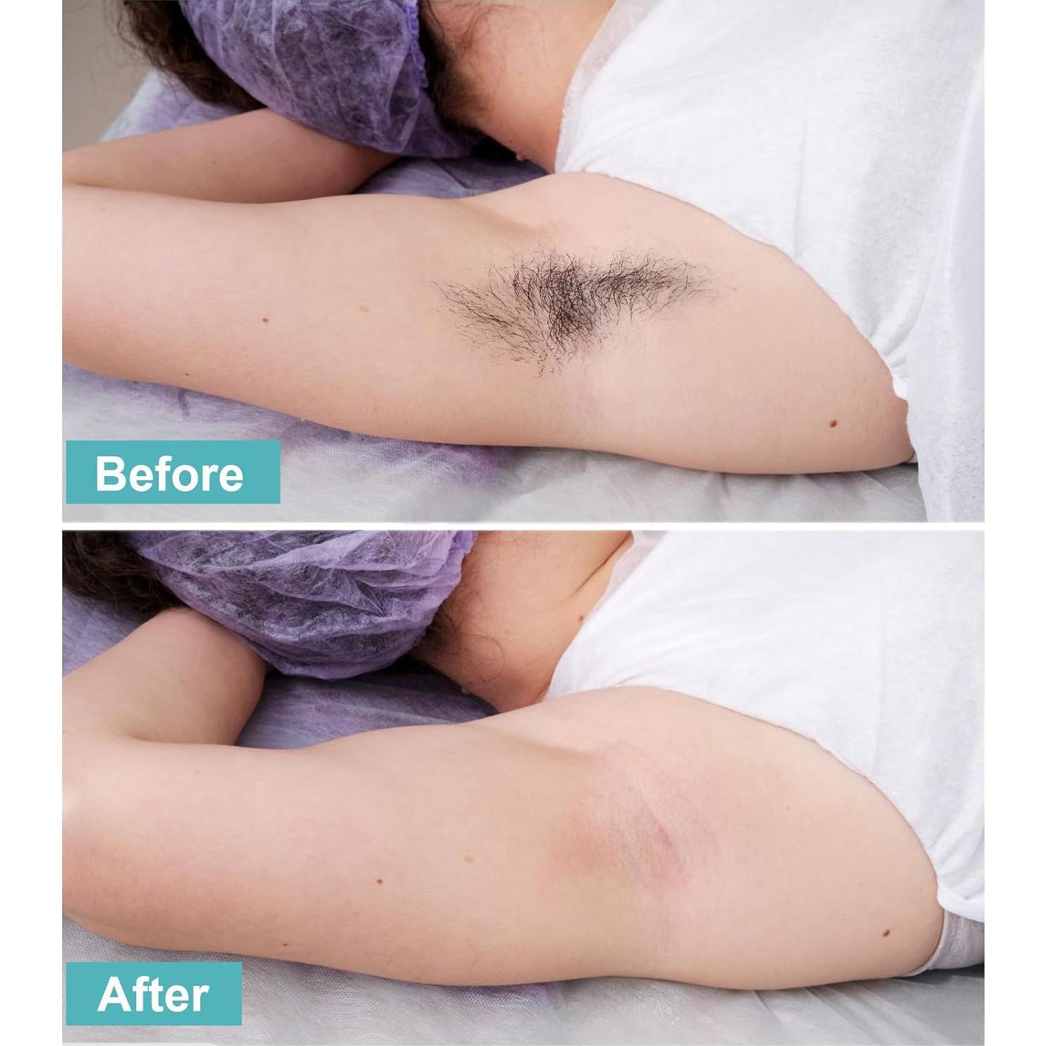 300 Tiras de Cera Charmonic para Depilación Facial y Corporal