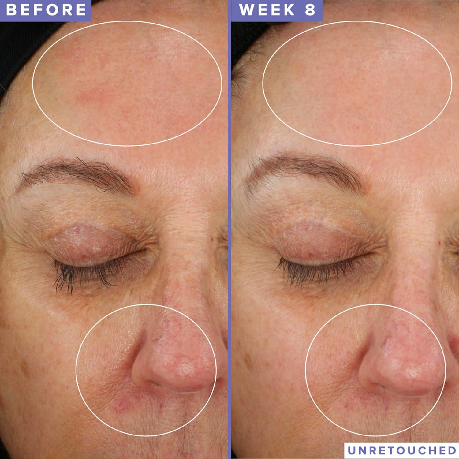 Mascarilla Facial Nocturna Farmacy 10% Niacinamida 8.8ml