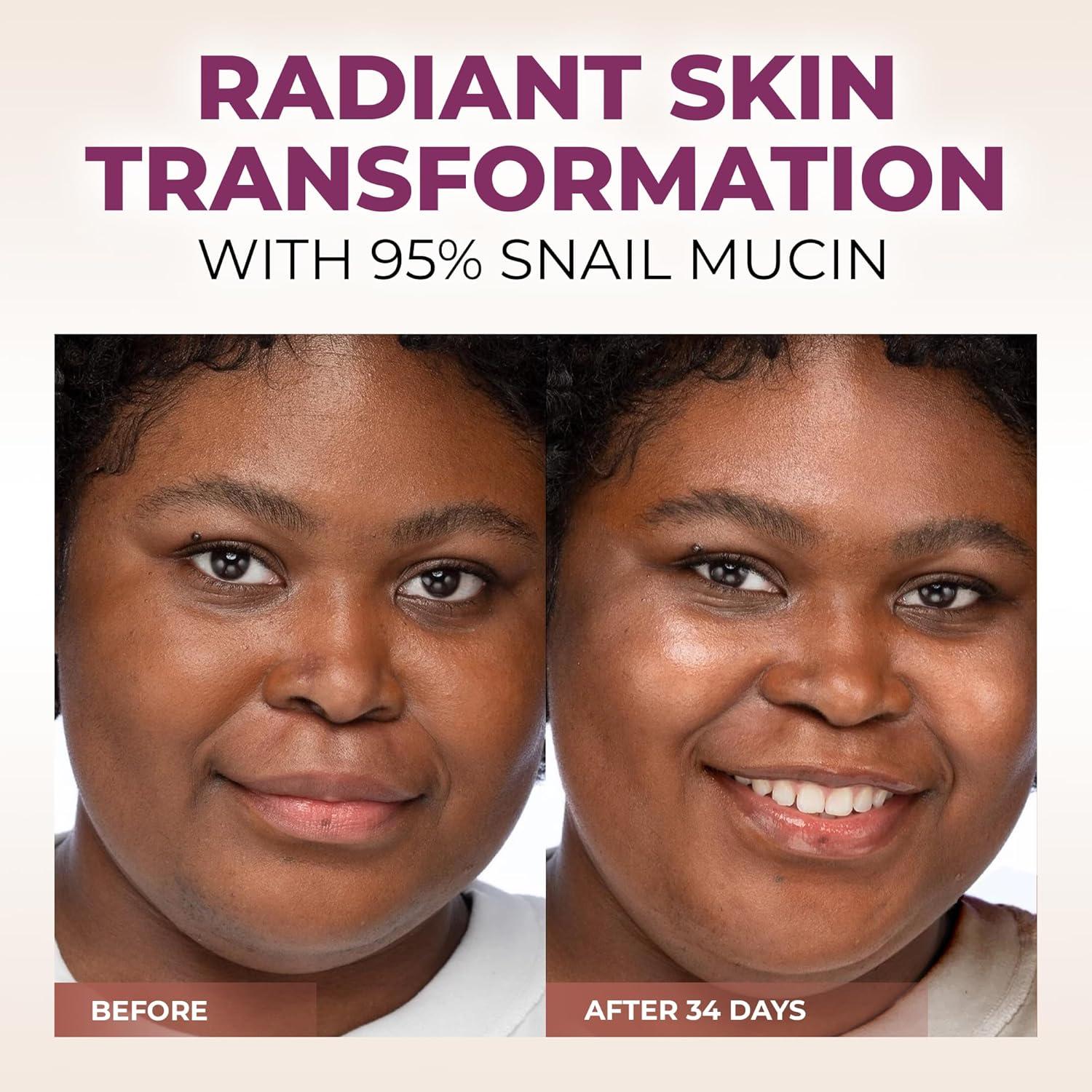 Suero de Mucina de Caracol Caresilk 100 ml - Hidratante Avanzado