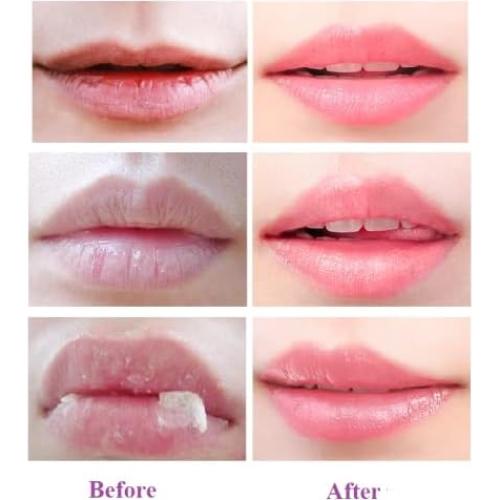 Bálsamo Labial Hidratante Ginaday 2 Pcs Tarro de Miel