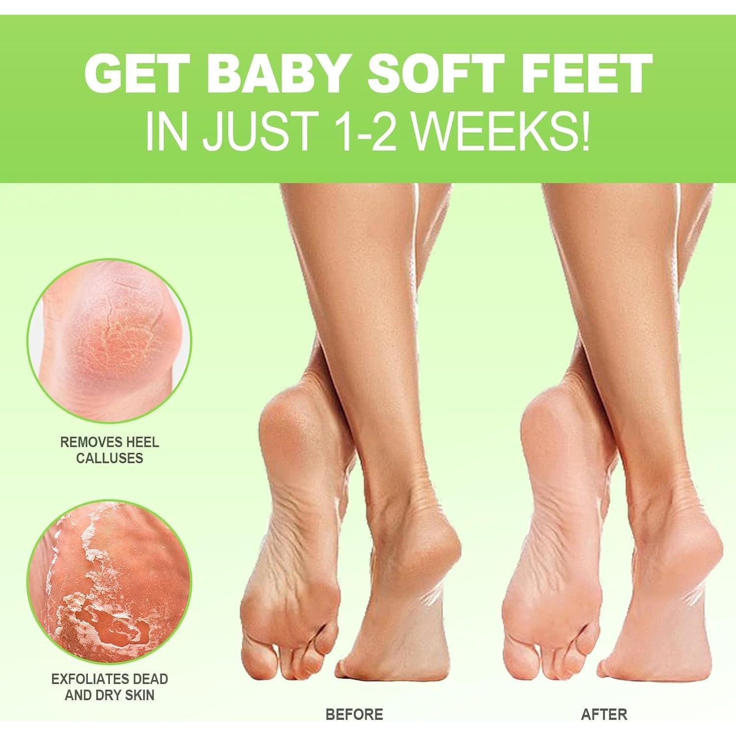 Mascarilla Exfoliante para Pies JVR - 3 Pares Aloe Vera