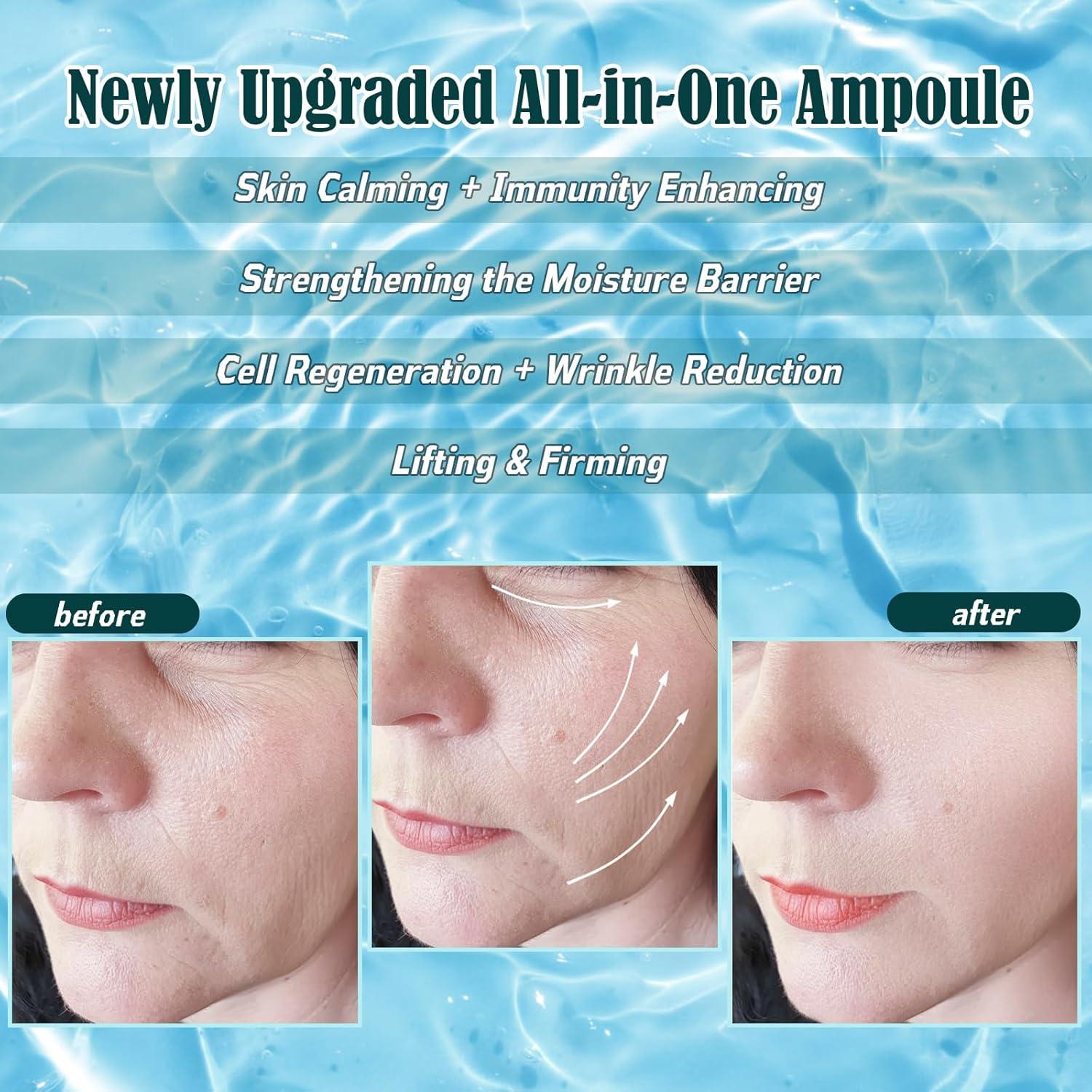 Ampolla Hidro ZEVOFIUR - Suero Facial Hidratante 5 Unidades