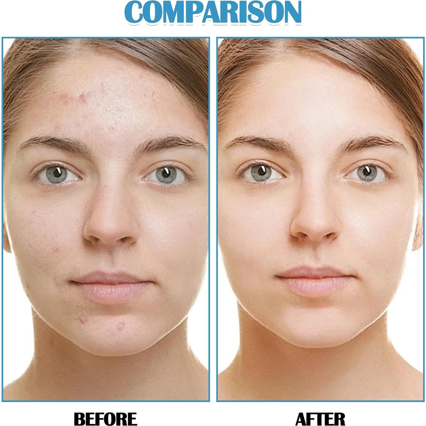 Paquete de 3 mascarillas faciales de colágeno JunKuJK - Hidratantes