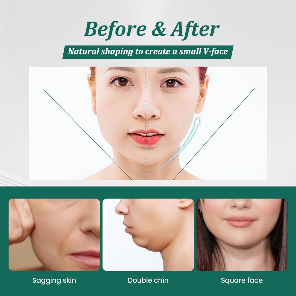 Correa de Levantamiento Facial V Auro Thread - Reutilizable, Alivia Flacidez y Doble Papada