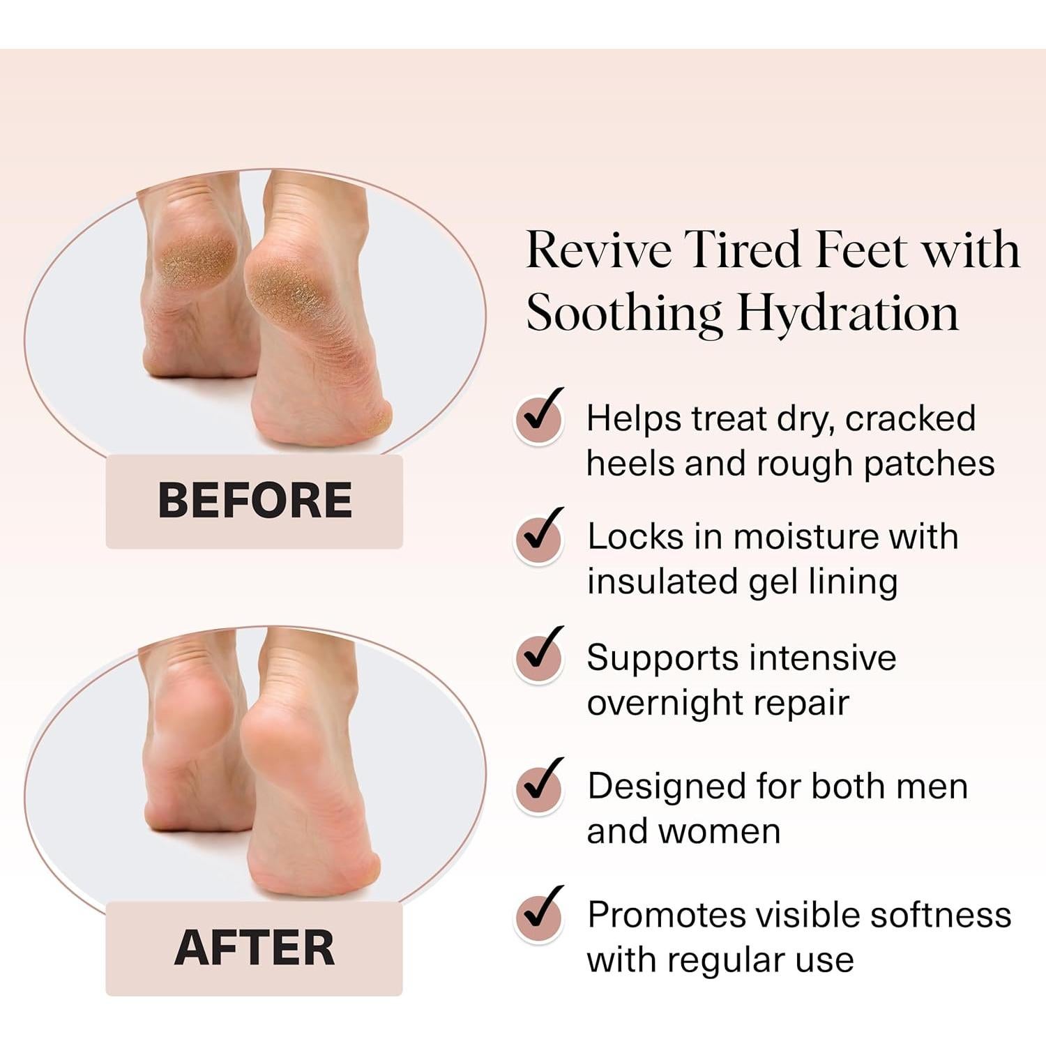 Calcetines Hidratantes Kitsch para Talones Agrietados - 1 Par