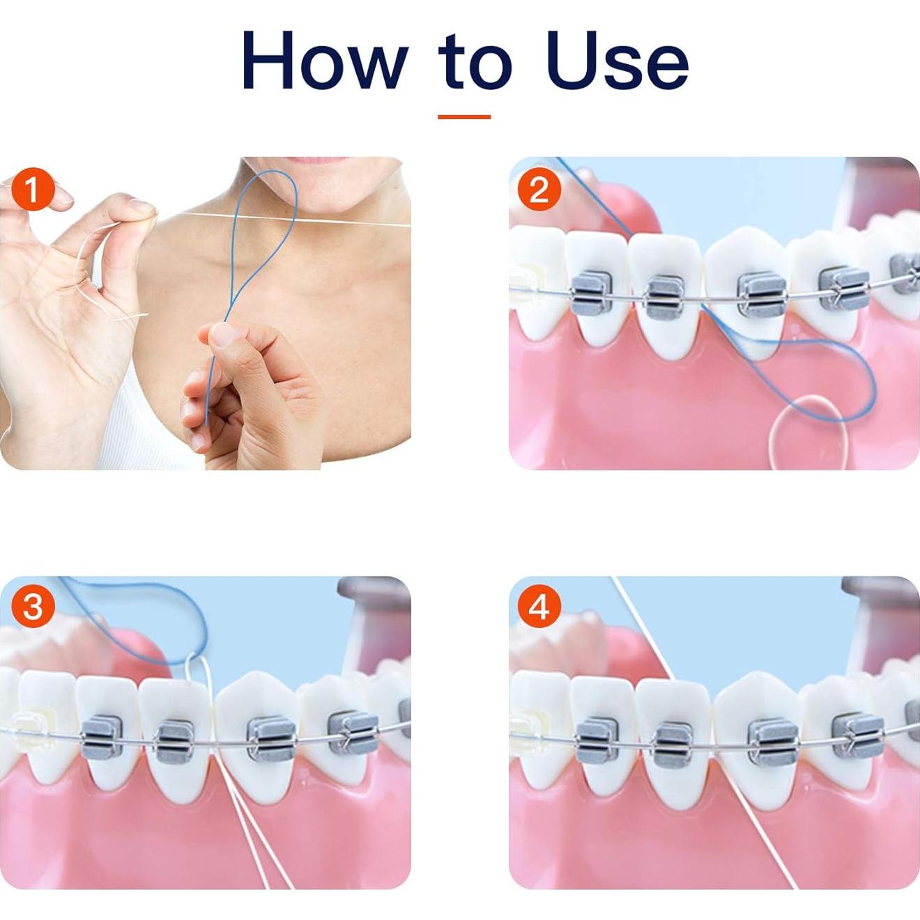 Hilos de Seda Dental VINSULLA para Brackets y Puentes - 300 Unidades