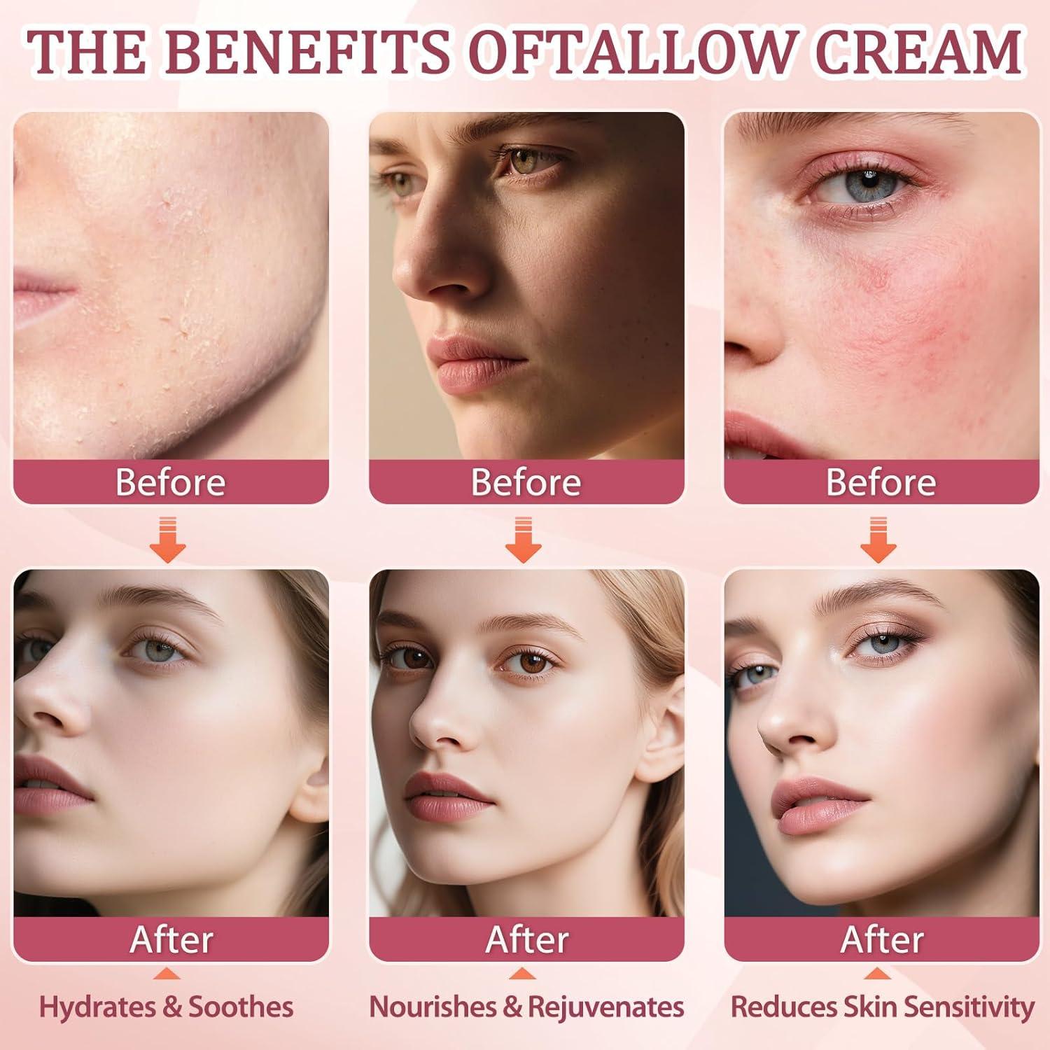 Crema Hidratante Facial de Grasa de Res GARPGONA 220g Nube