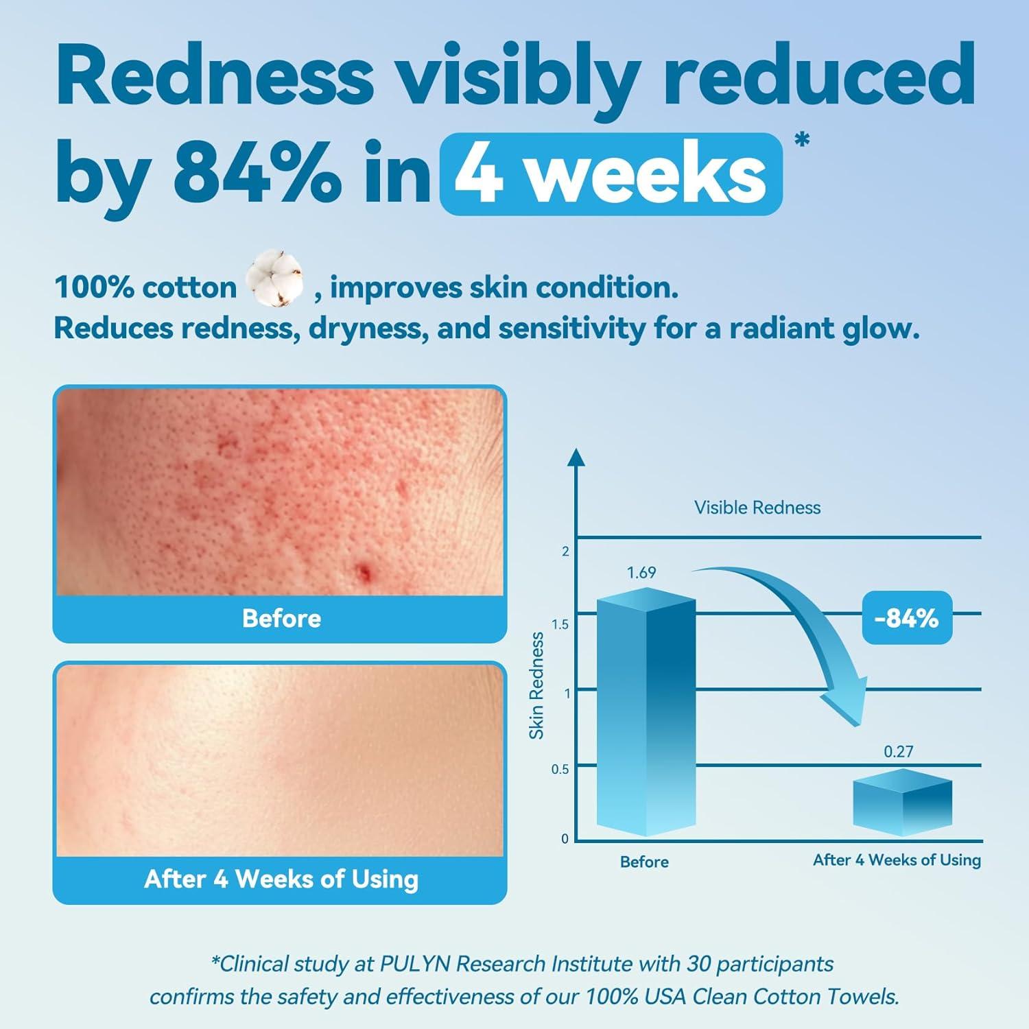 Toallas Faciales Desechables Winner de Algodón Biodegradables 100 Unidades