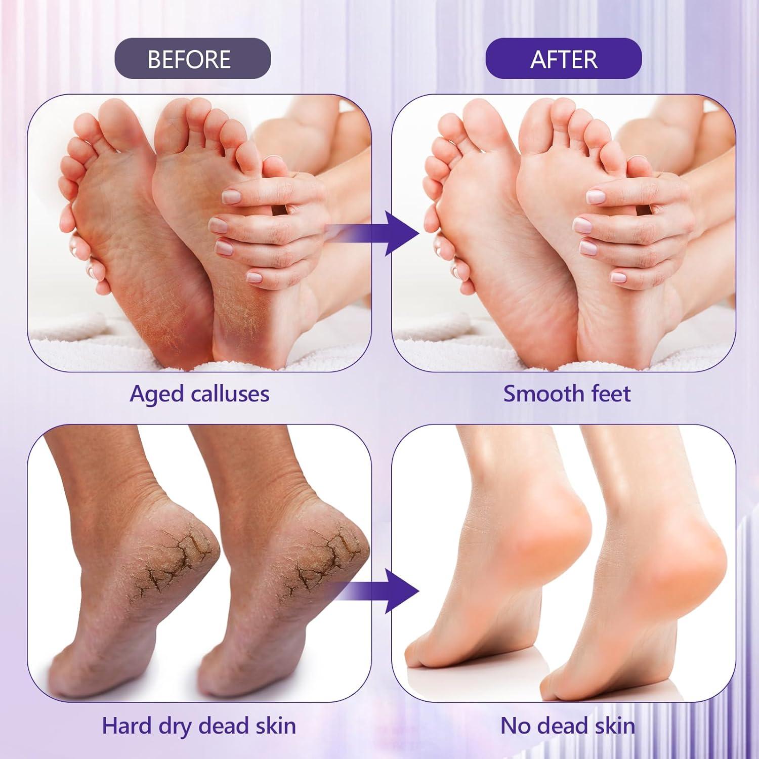 Discos de Lija para Pedicura Krofaue 60 Pcs 60 Granos