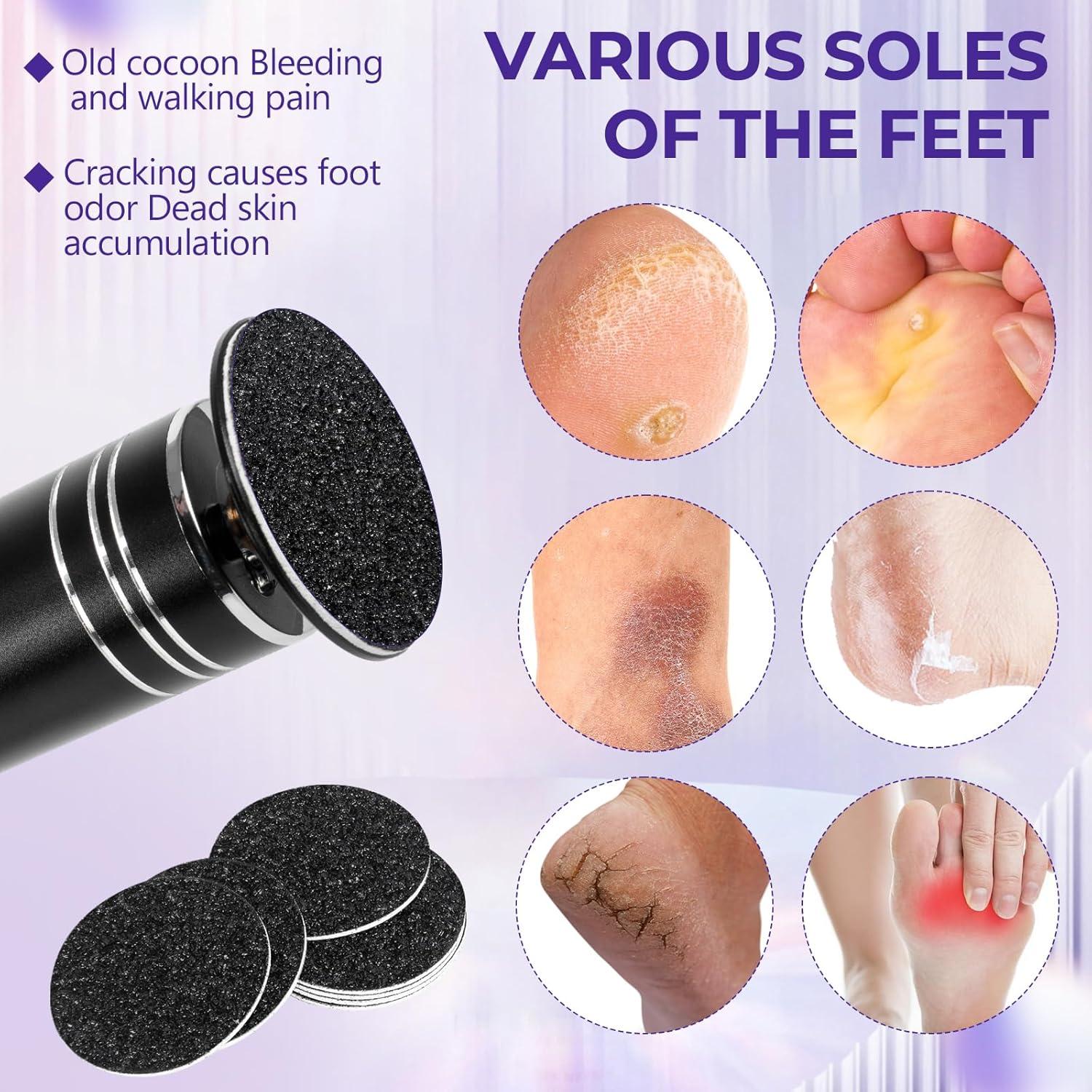 Discos de Lija para Pedicura Krofaue 60 Pcs 60 Granos