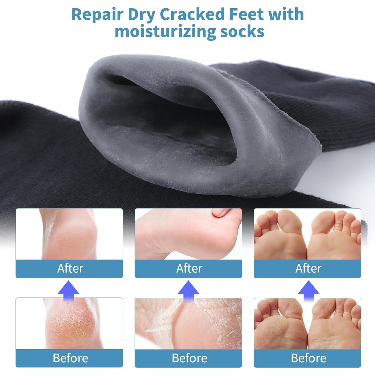 Calcetines Hidratantes de Silicona ALUROICE Talla L 1 Par