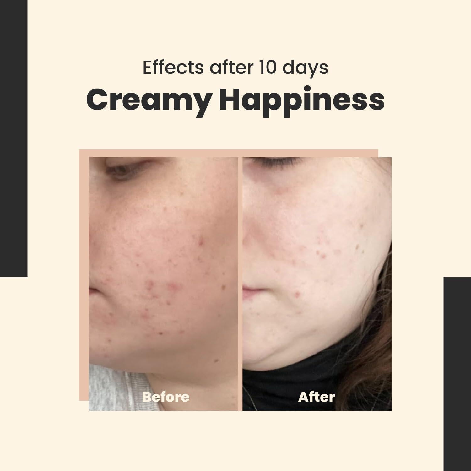 Emulsión de Retinal Avanzada 0.1% Felicidad Cremosa 30 ml