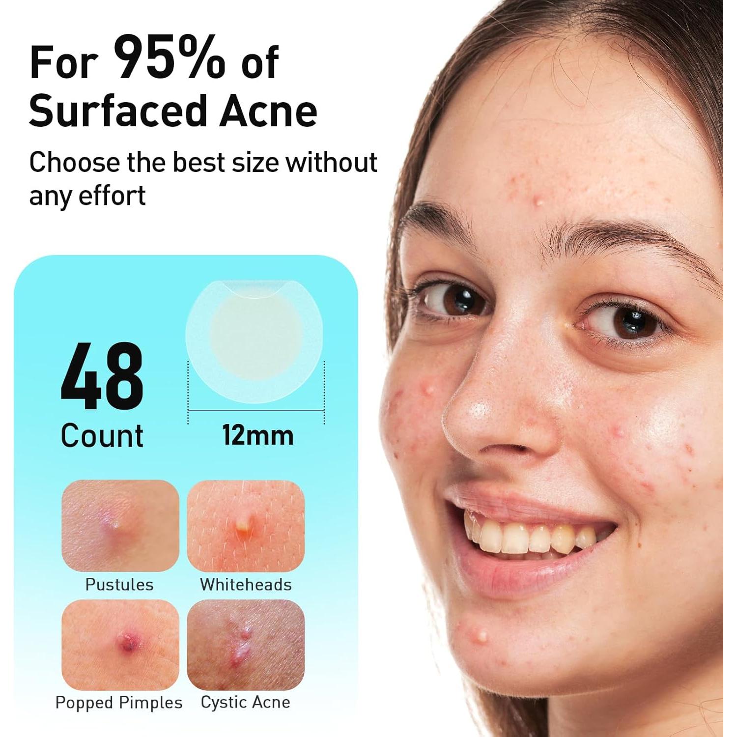 Parches para Acné TKTK 12 mm Hidrocoloide 48 Unidades