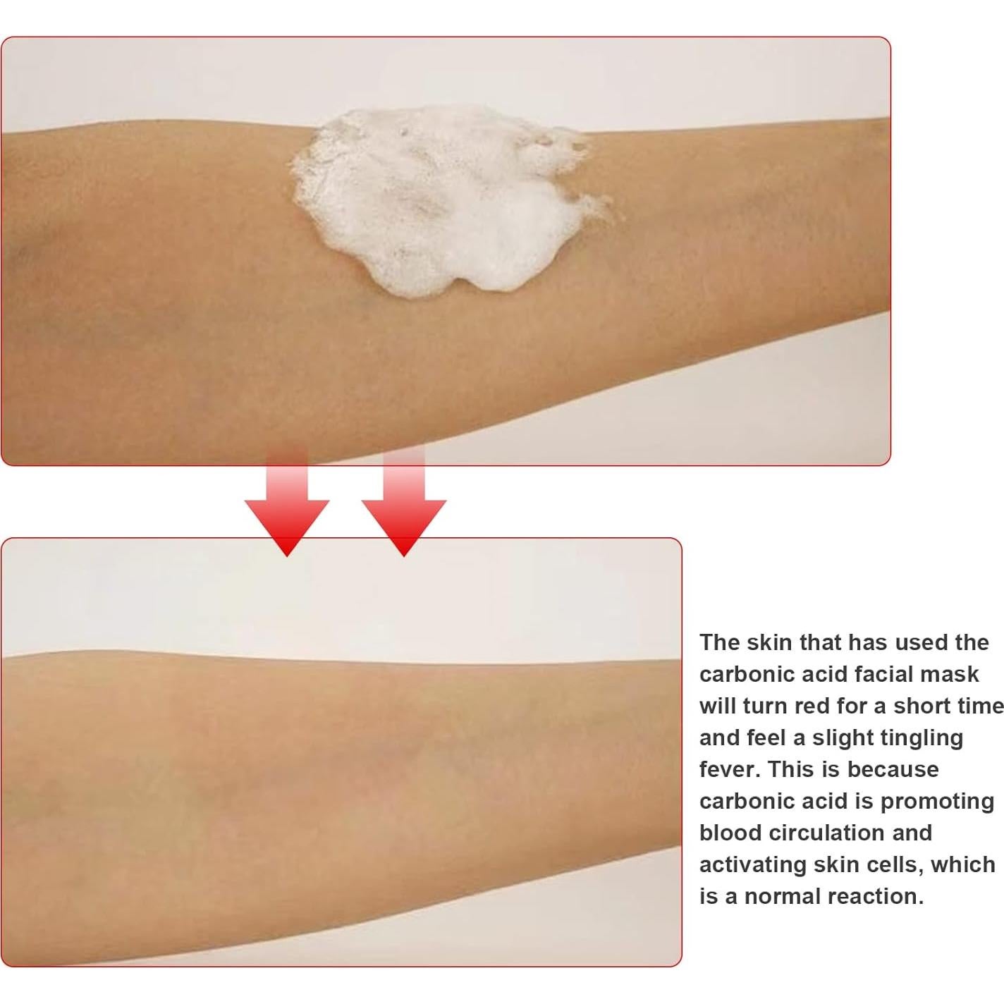 Mascarilla Facial CO2 Elitzia 20 Bolsas Hidratante Azul