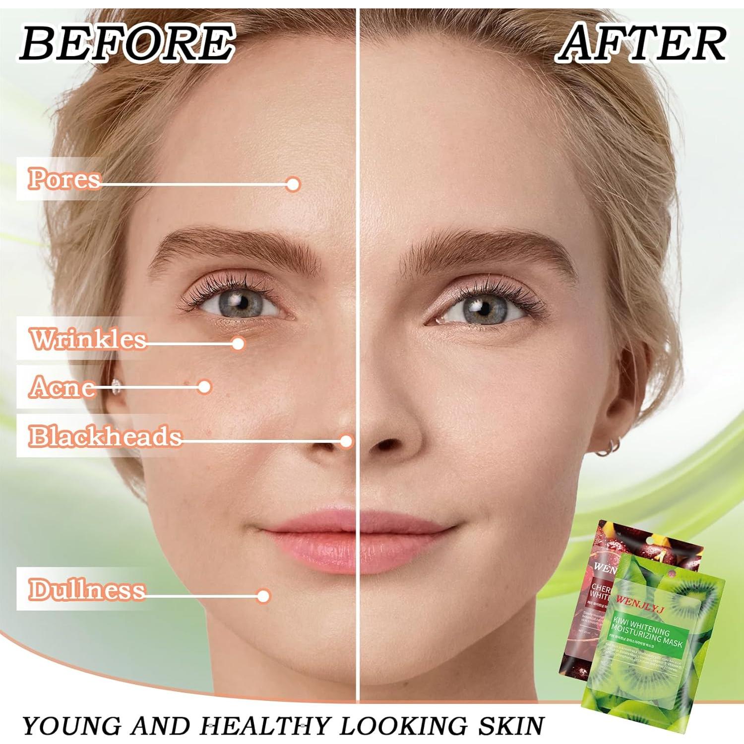 Conjunto de 22 Mascarillas Faciales Hidratantes WENJLYJ