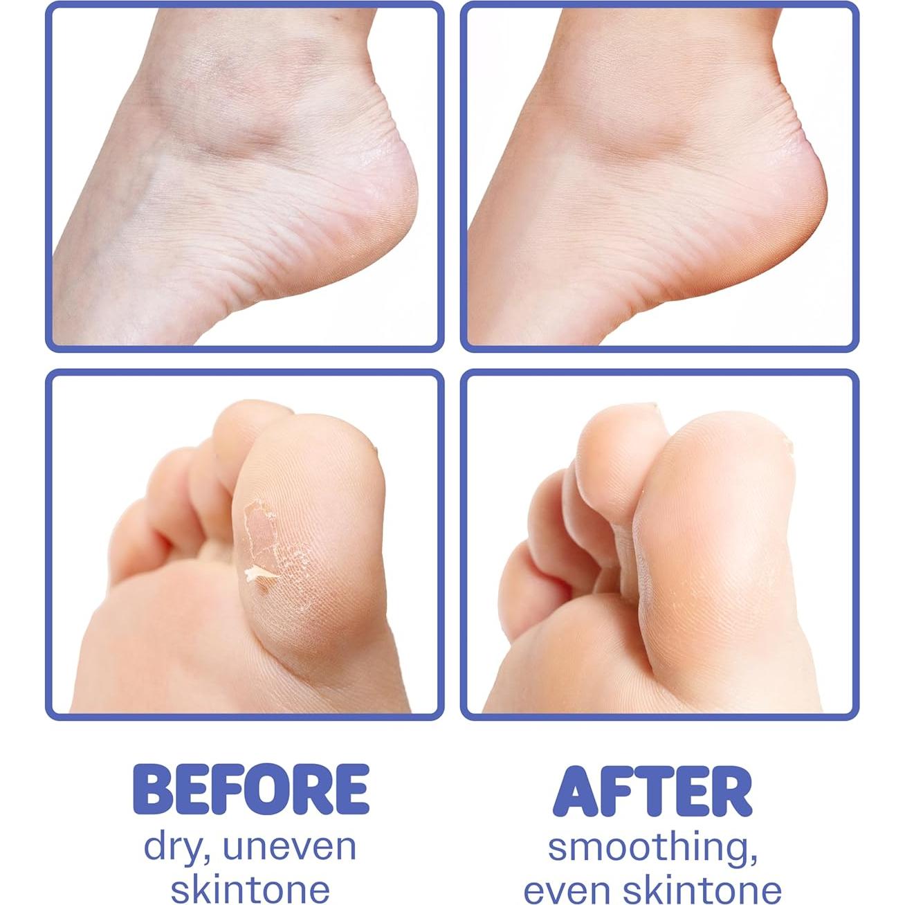 Mascarilla Hidratante para Pies Secos ONSOI 6PK Coco + Cica