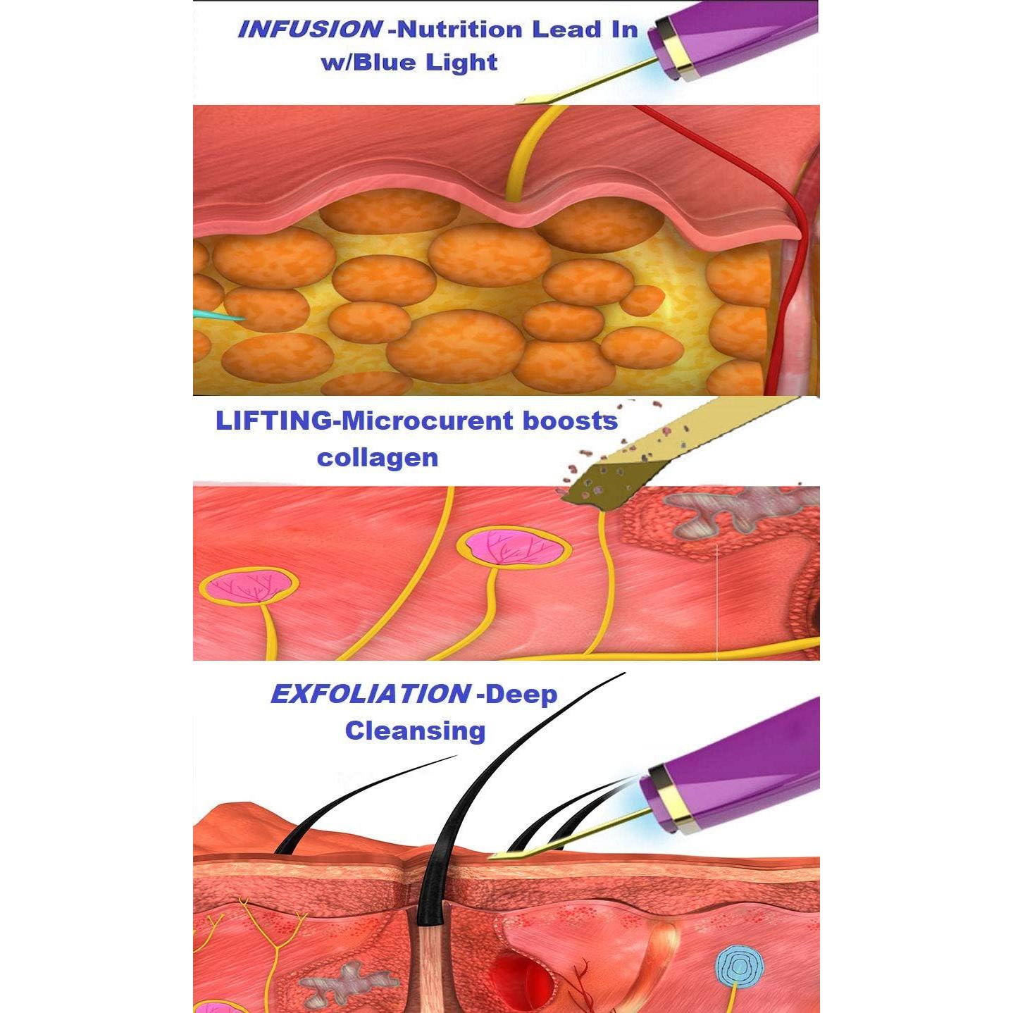 Exfoliador de Piel Trifecta Skin 3-en-1 Oro 24K Recargable