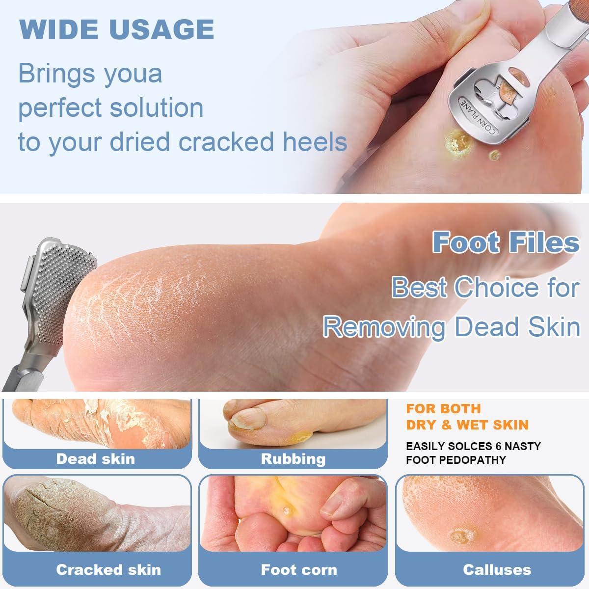 Removedor de Callos de Acero Inoxidable POQOD con 12 Piezas