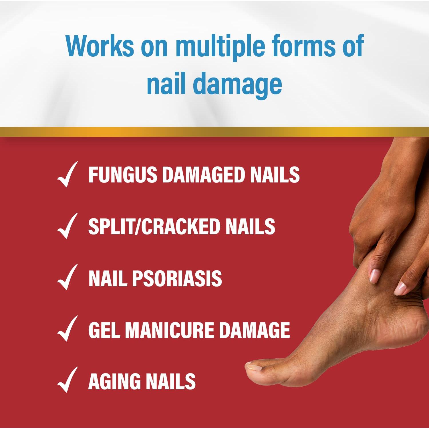 Kerasal Reparador de Uñas Multiusos 12.7 ml - Hidratante y Exfoliante