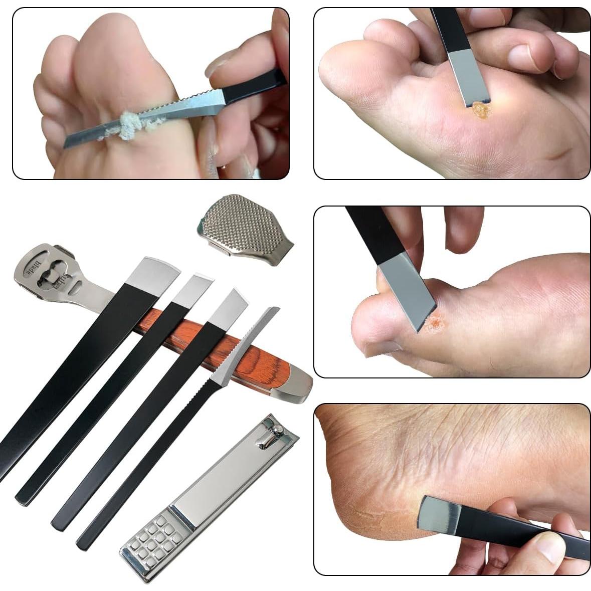 Juego de Raspador de Callos 37 Piezas NZRAQK con Lima y Cuchillas