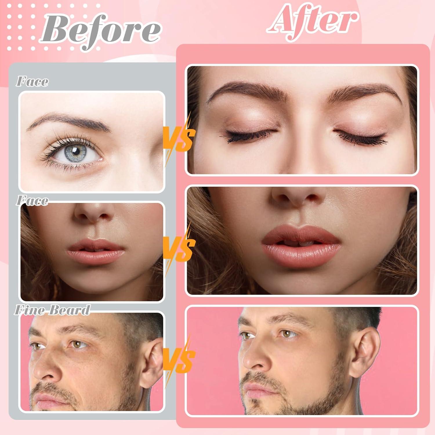 Cuchillas Dermaplane ProSuites 16 Piezas para Vello Facial