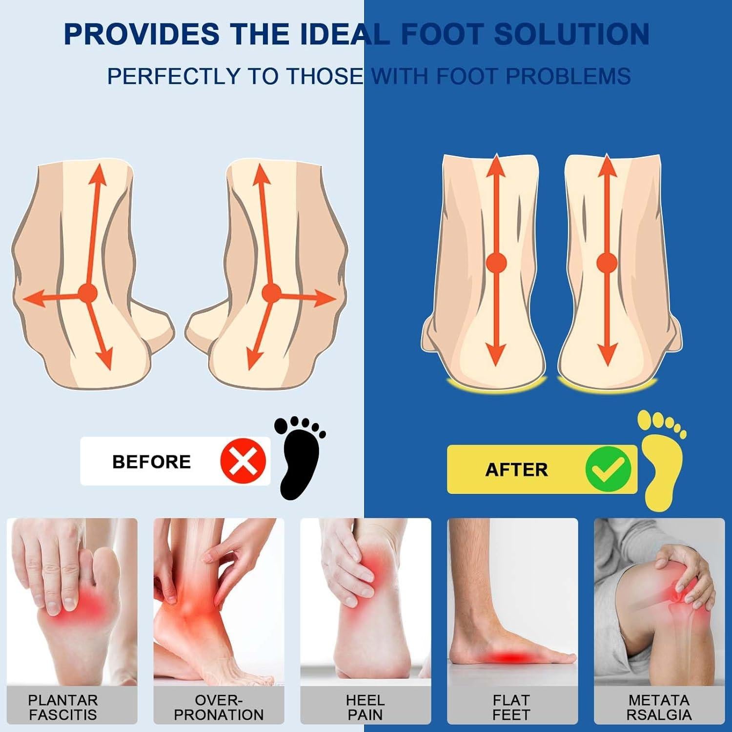 Plantillas de Soporte de Arco Alto Crinova para Fascitis Plantar
