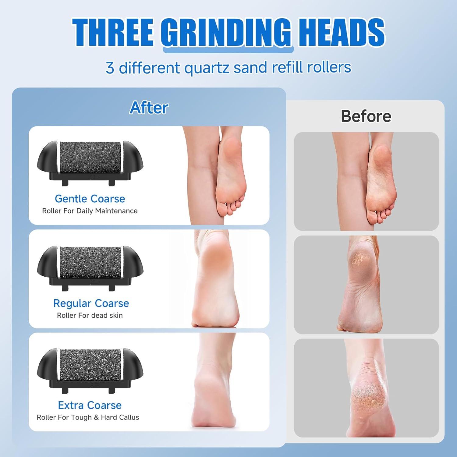 Removedor de Callos Eléctrico NetCan 17 en 1 Portátil Negro