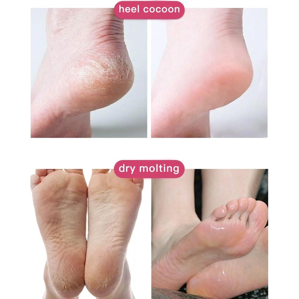 Mascarilla Exfoliante para Pies YUYAJK 8pcs Hidratante Mezclado