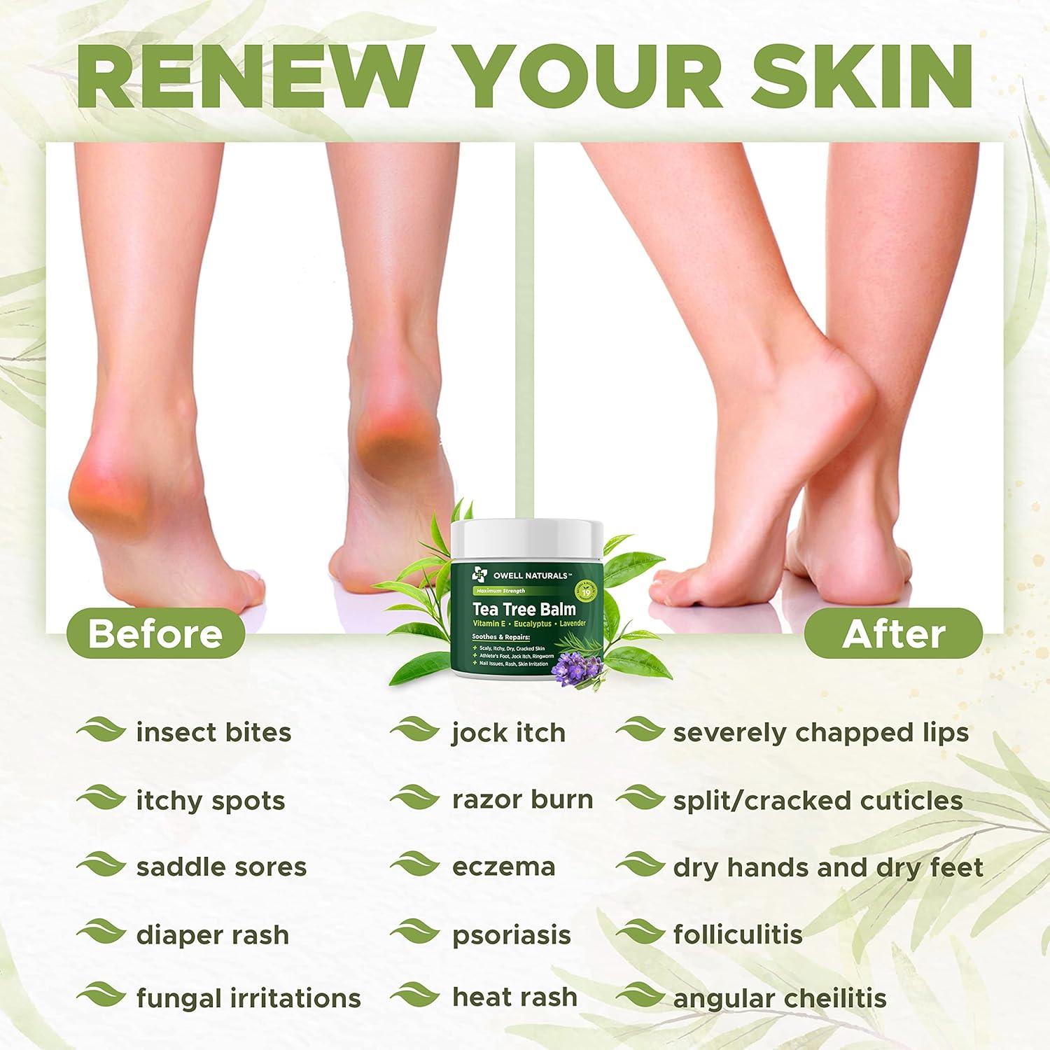 Bálsamo de Árbol de Té Owell Naturals 59 ml - Piel Seca y Agrietada