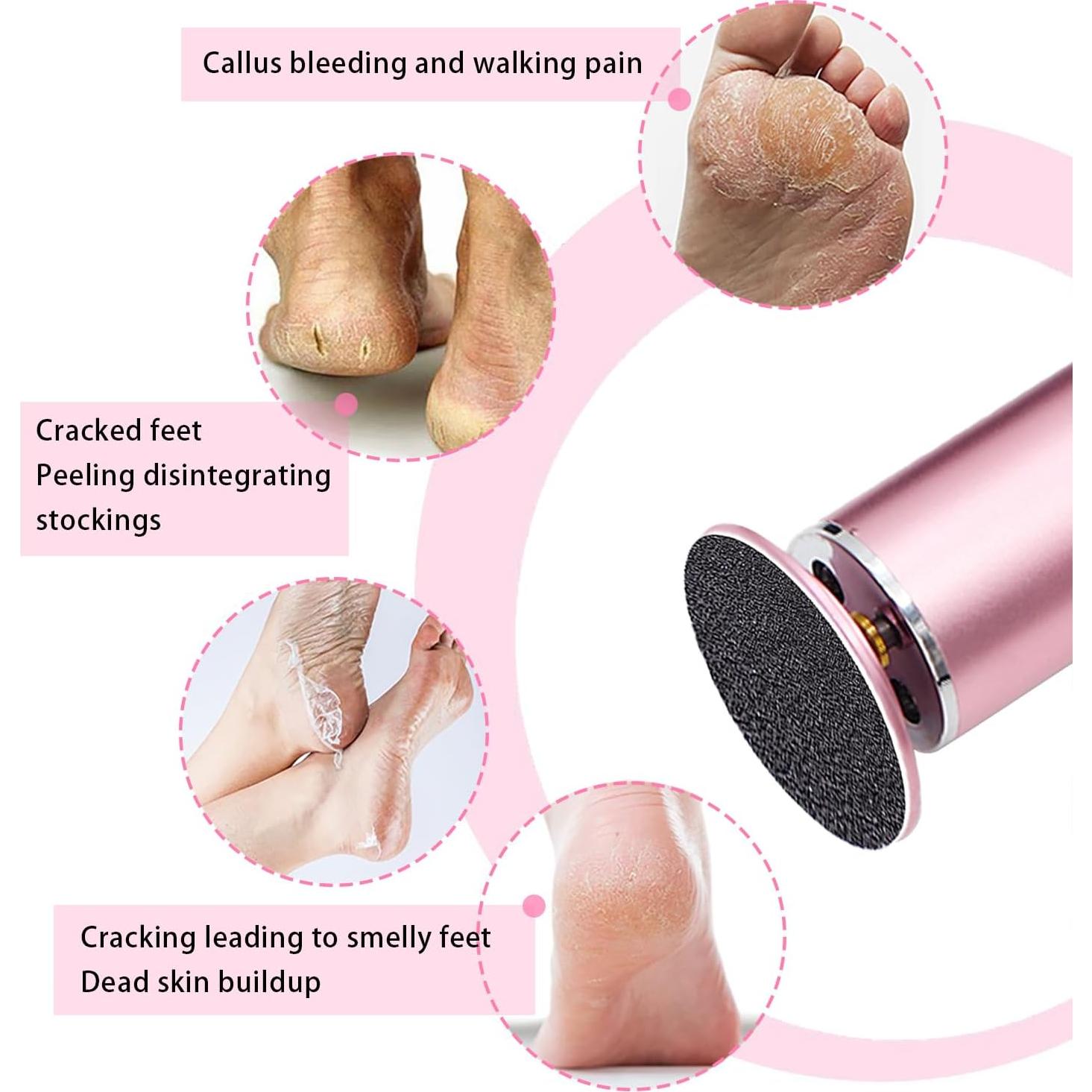 Juego de 60 Discos de Lija para Removedor de Callos HayZBao - 30 Grano Fino y 30 Grano Grueso