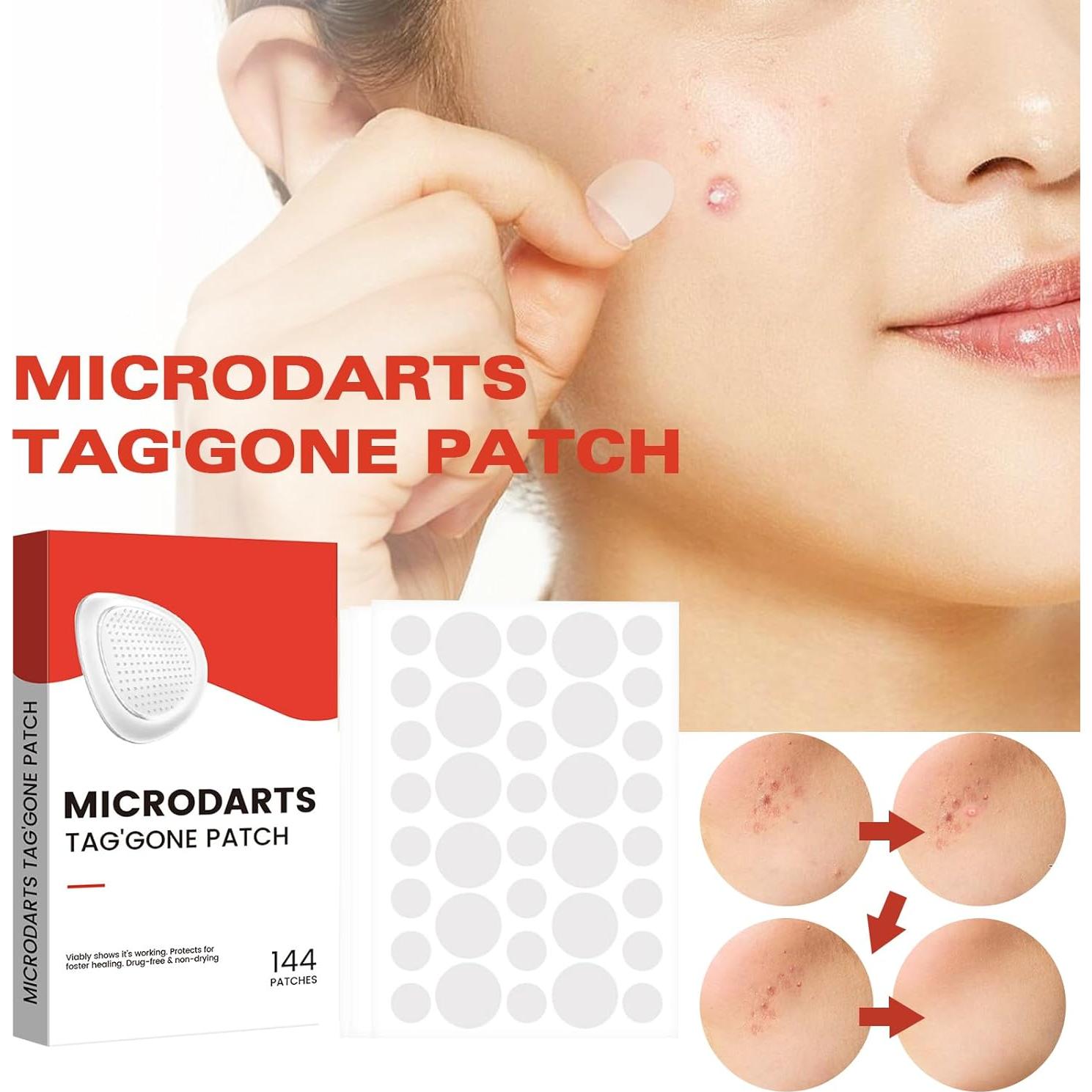 Parches Microdarts Pro Gtyuoo para Acné - 144 Piezas