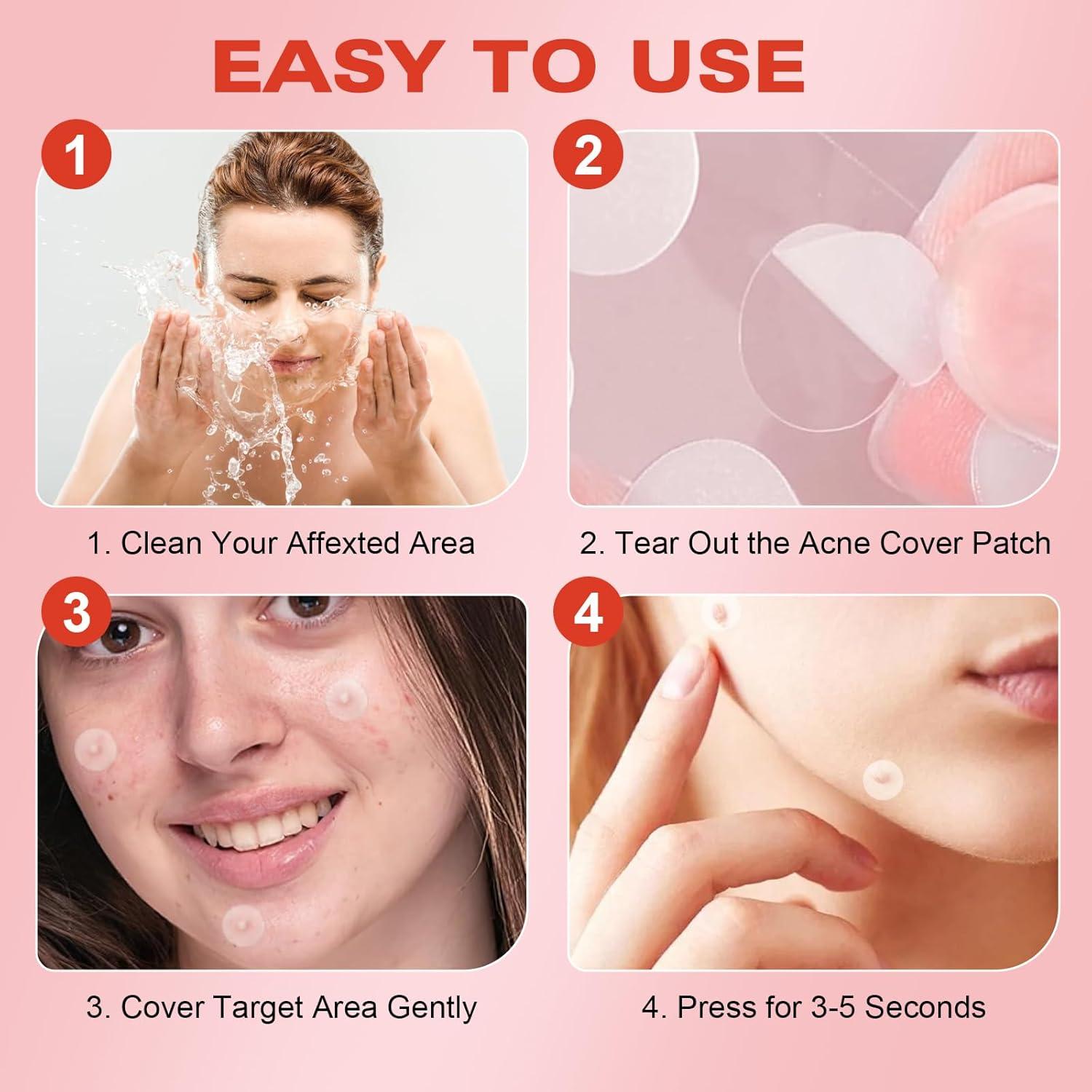 Parches Microdarts Pro Gtyuoo para Acné - 144 Piezas