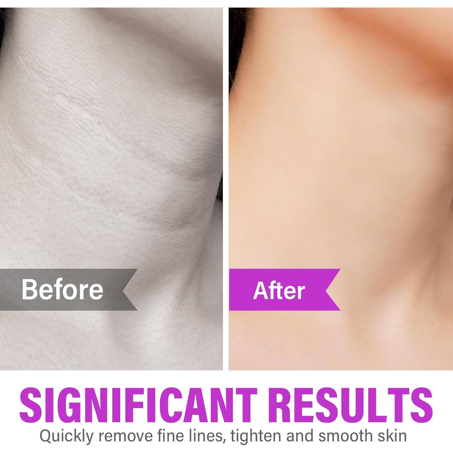 Rodillo de Radiancia HIPFATE de Piedra de Germanio para la Cara