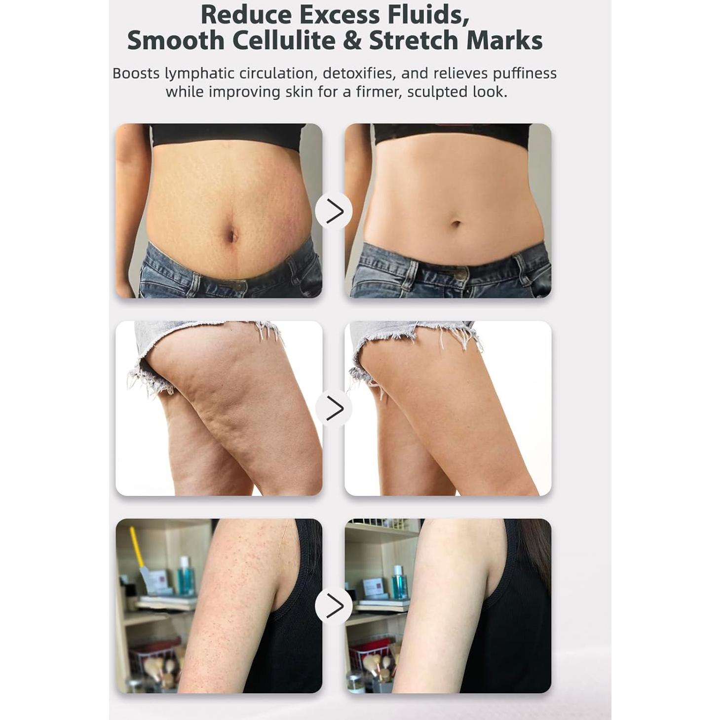 Masajeador Drenaje Linfático Paiaito 8x8x16cm Anticelulitis