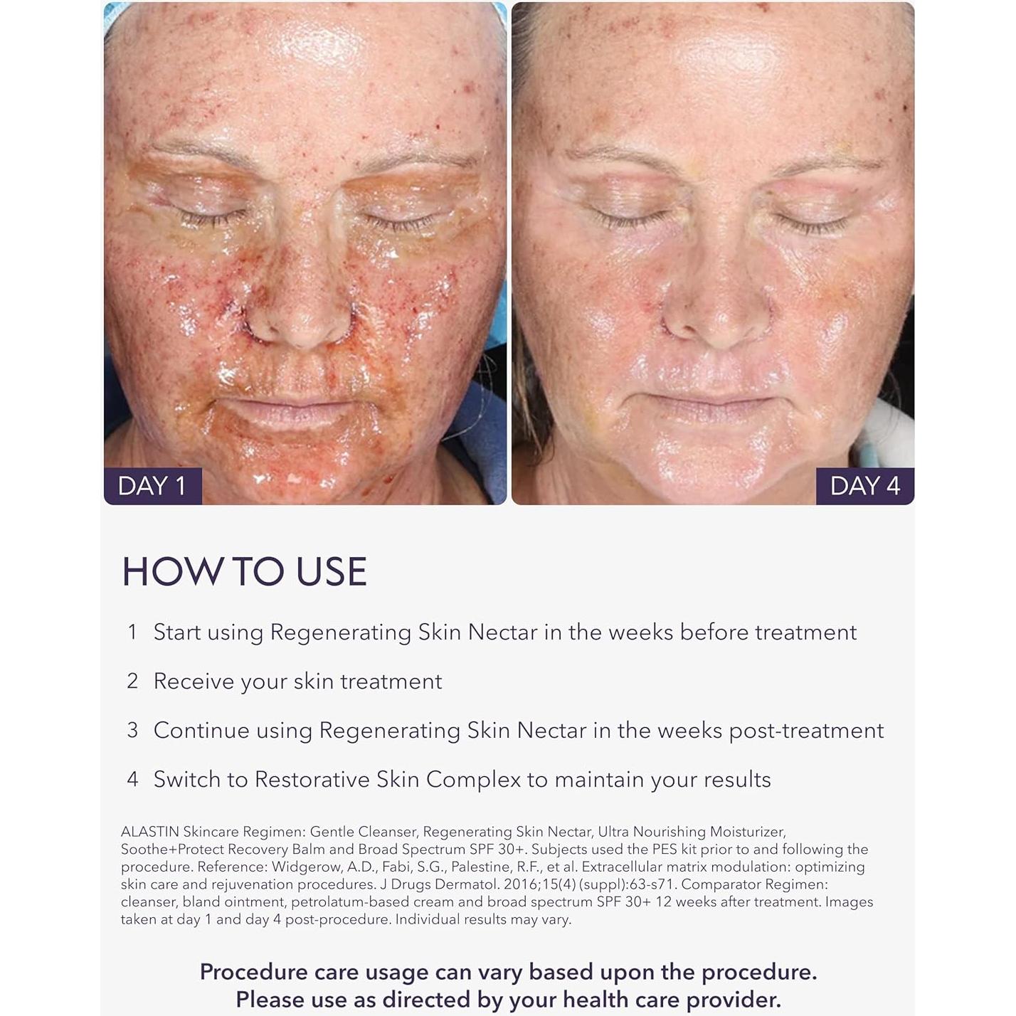 ALASTIN Nécar Regenerador Hidratante Facial 28.35 g - Piel Sensible