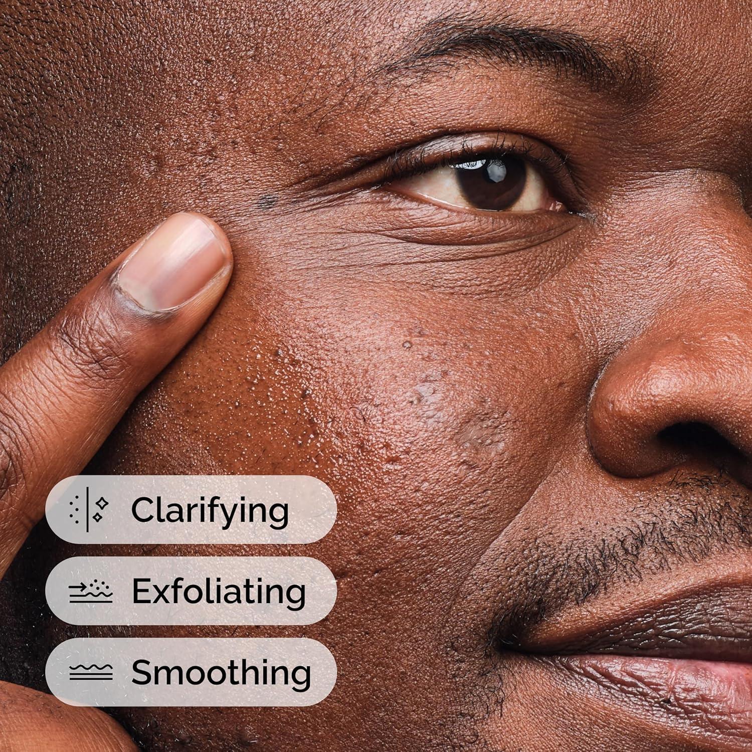 Suero Ácido Salicílico 2% The Ordinary 30 ml Piel Imperfecta