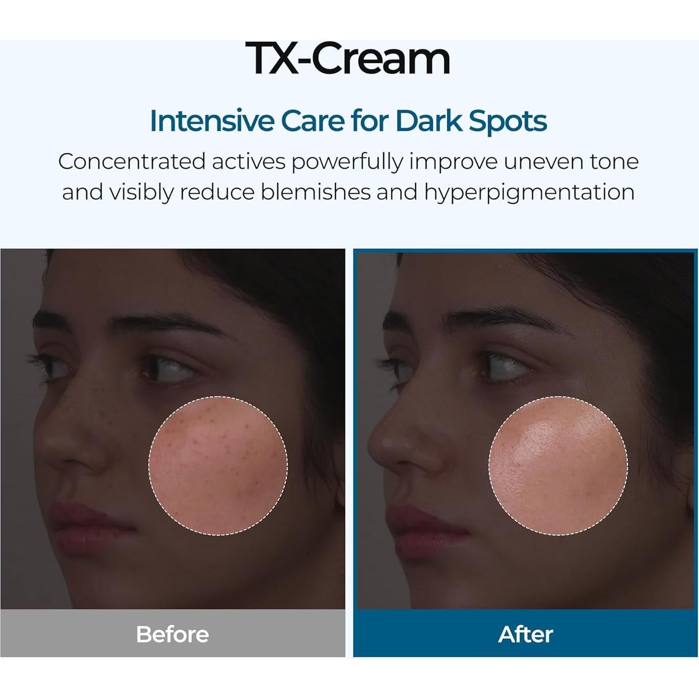 Crema Anti-Pigmentación Dr.Melaxin con Ácido Tranexámico 50ml