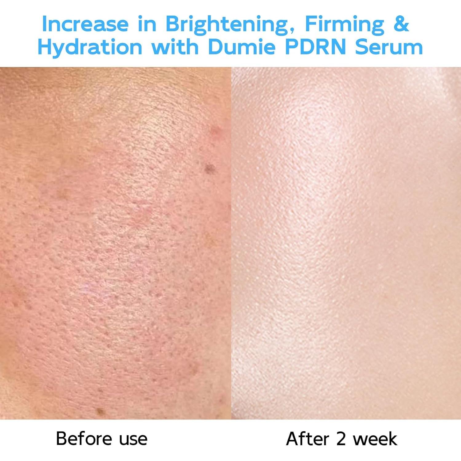 Suero Anti-Envejecimiento Dumie 30 Tubos 1.5ml PDRN ADN Salmón