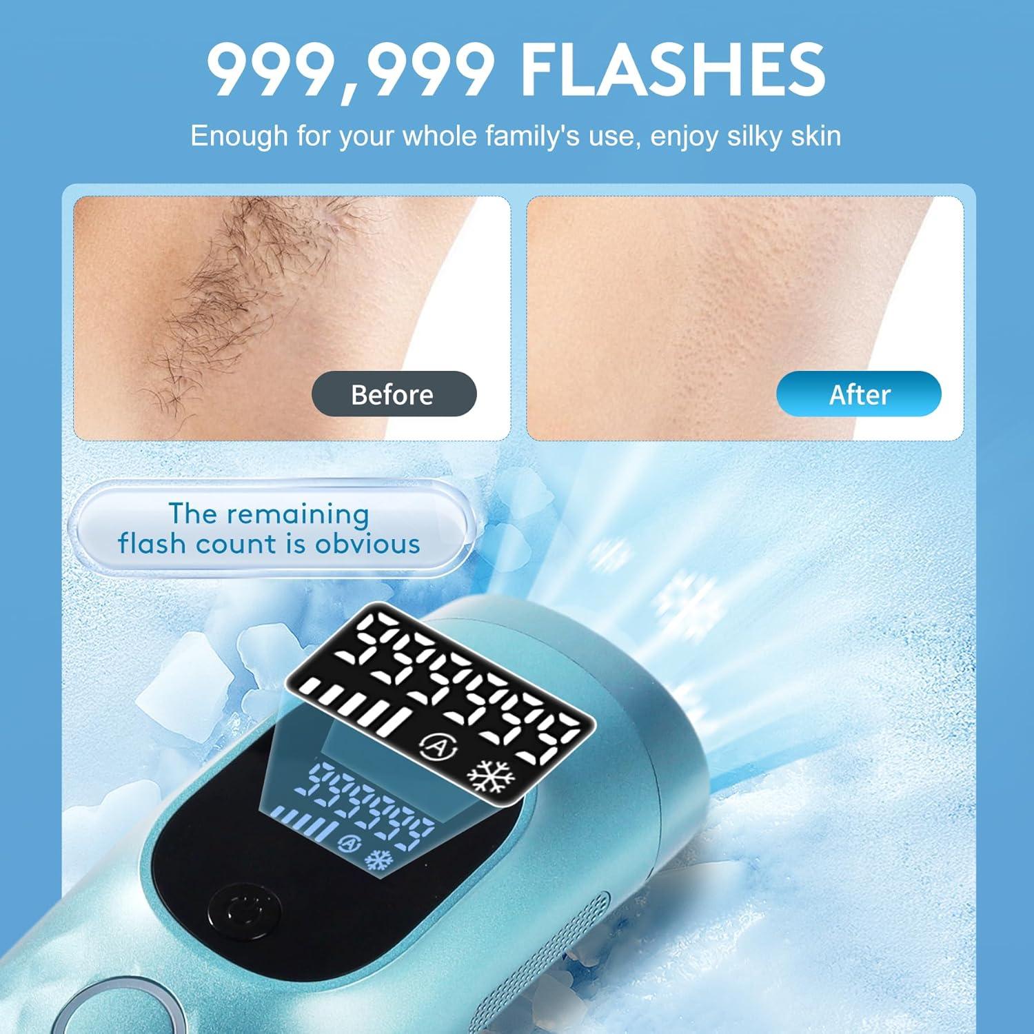 Dispositivo IPL de Eliminación de Vello Permanente Miley - 999,999 Destellos, Enfriamiento Indoloro, 5 Niveles de Potencia