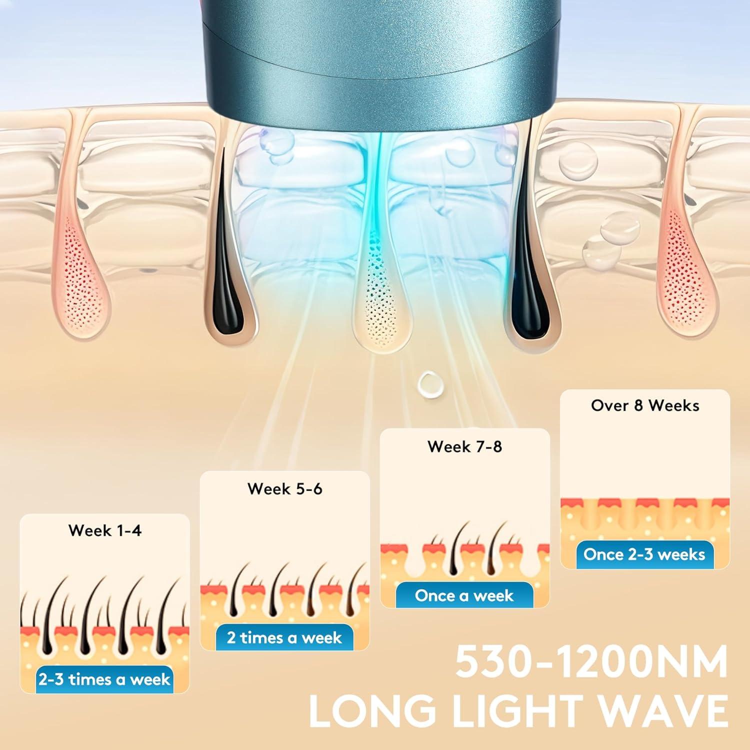 Dispositivo IPL de Eliminación de Vello Permanente Miley - 999,999 Destellos, Enfriamiento Indoloro, 5 Niveles de Potencia