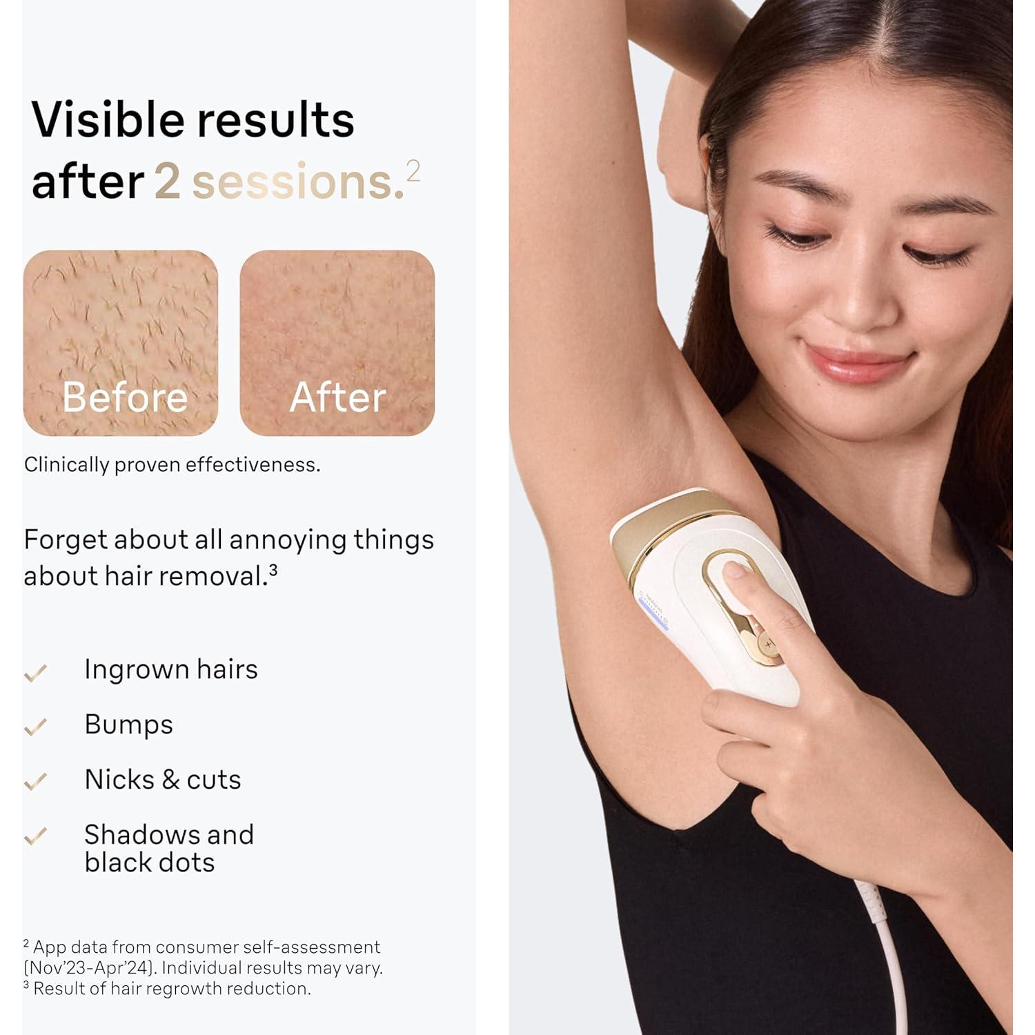 Depiladora láser Braun Silk·Expert Pro 5 IPL5157, reducción vello