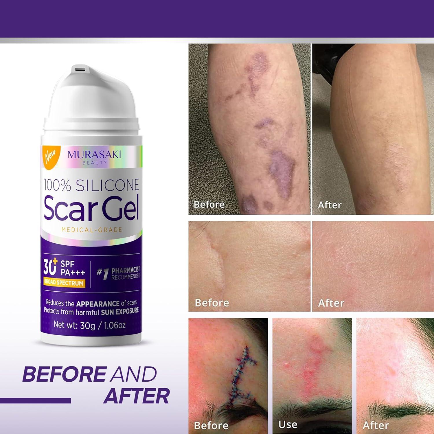 Gel de Cicatrices MURASAKI BEAUTY 30g con SPF 30 - Fórmula Avanzada