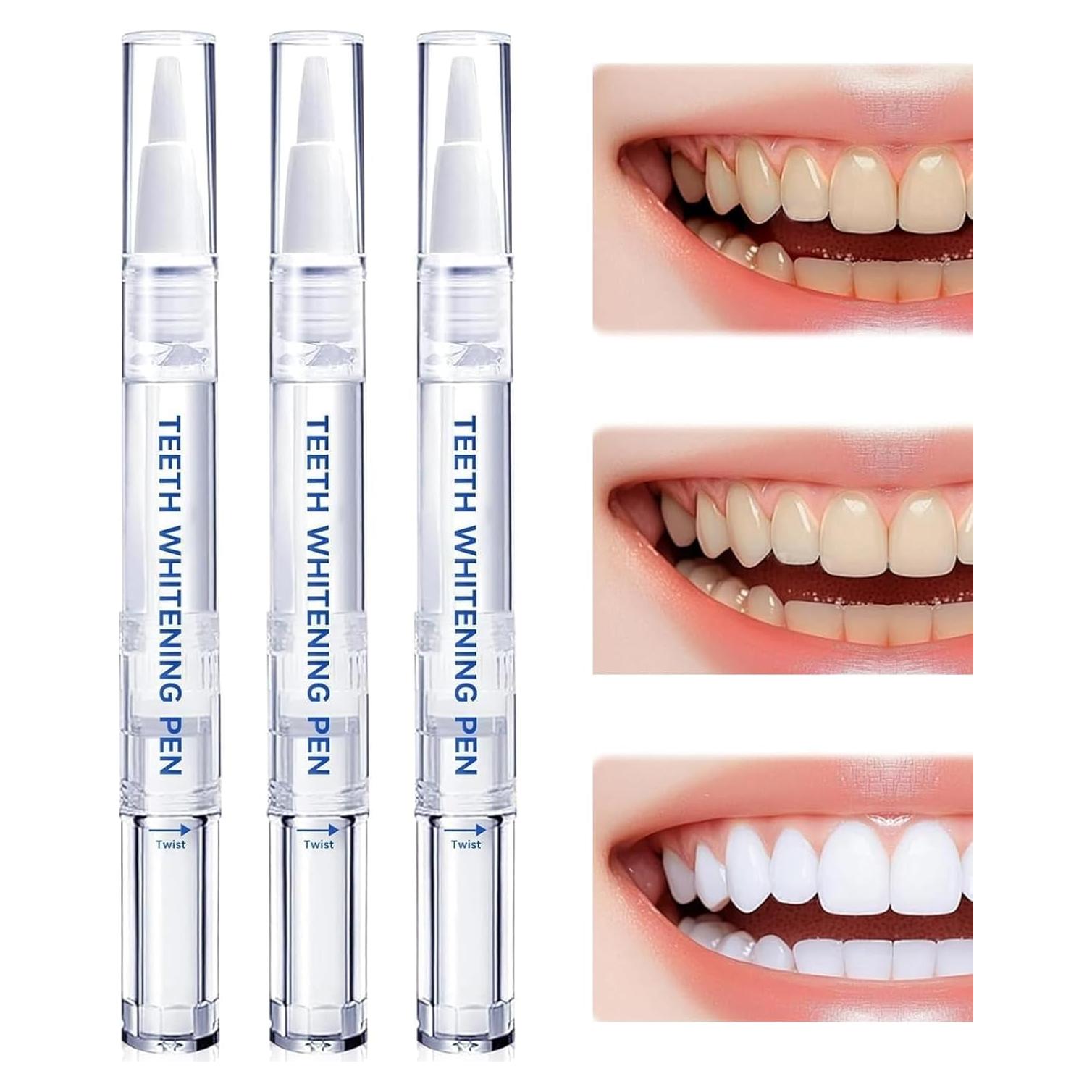 Bolígrafo Blanqueador de Dientes Gpoizmo - Gel Profesional